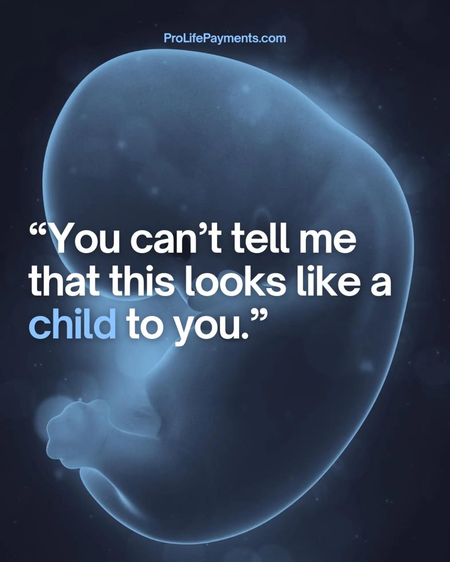 @Pro Life Payments