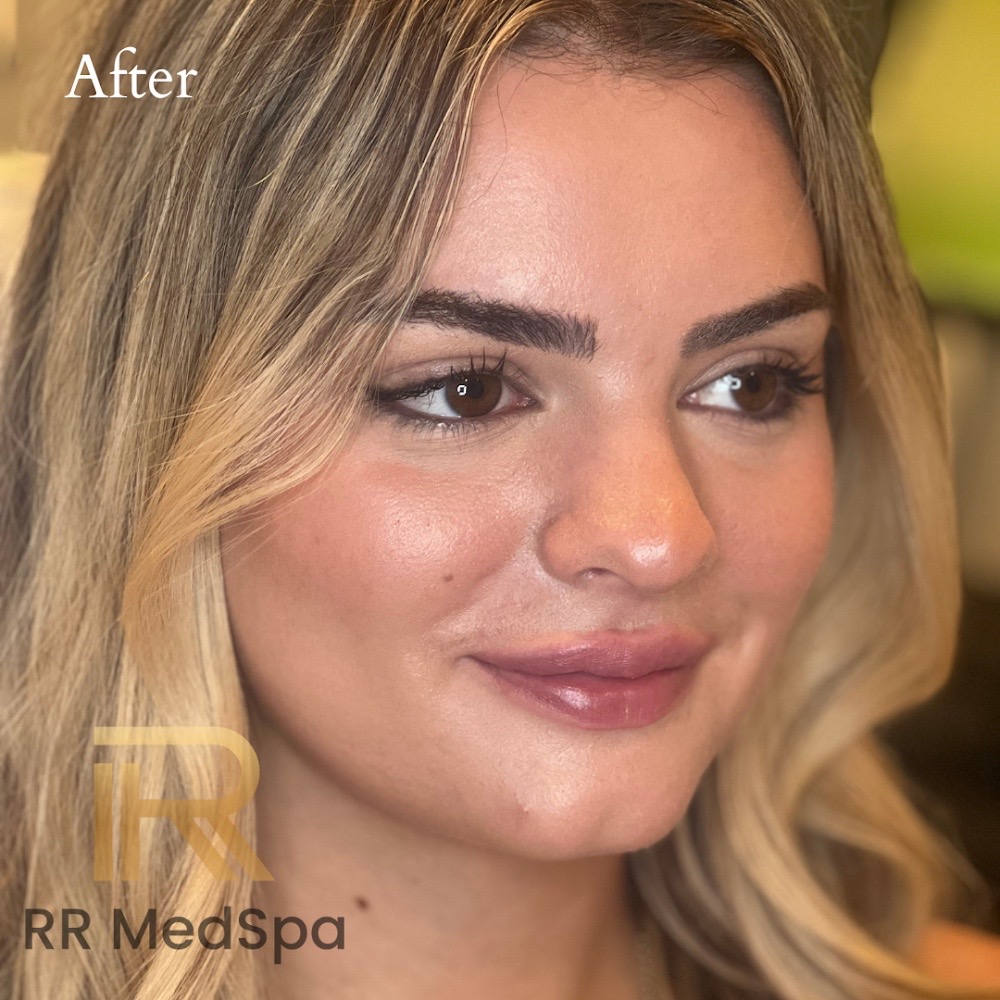 @RR Medspa