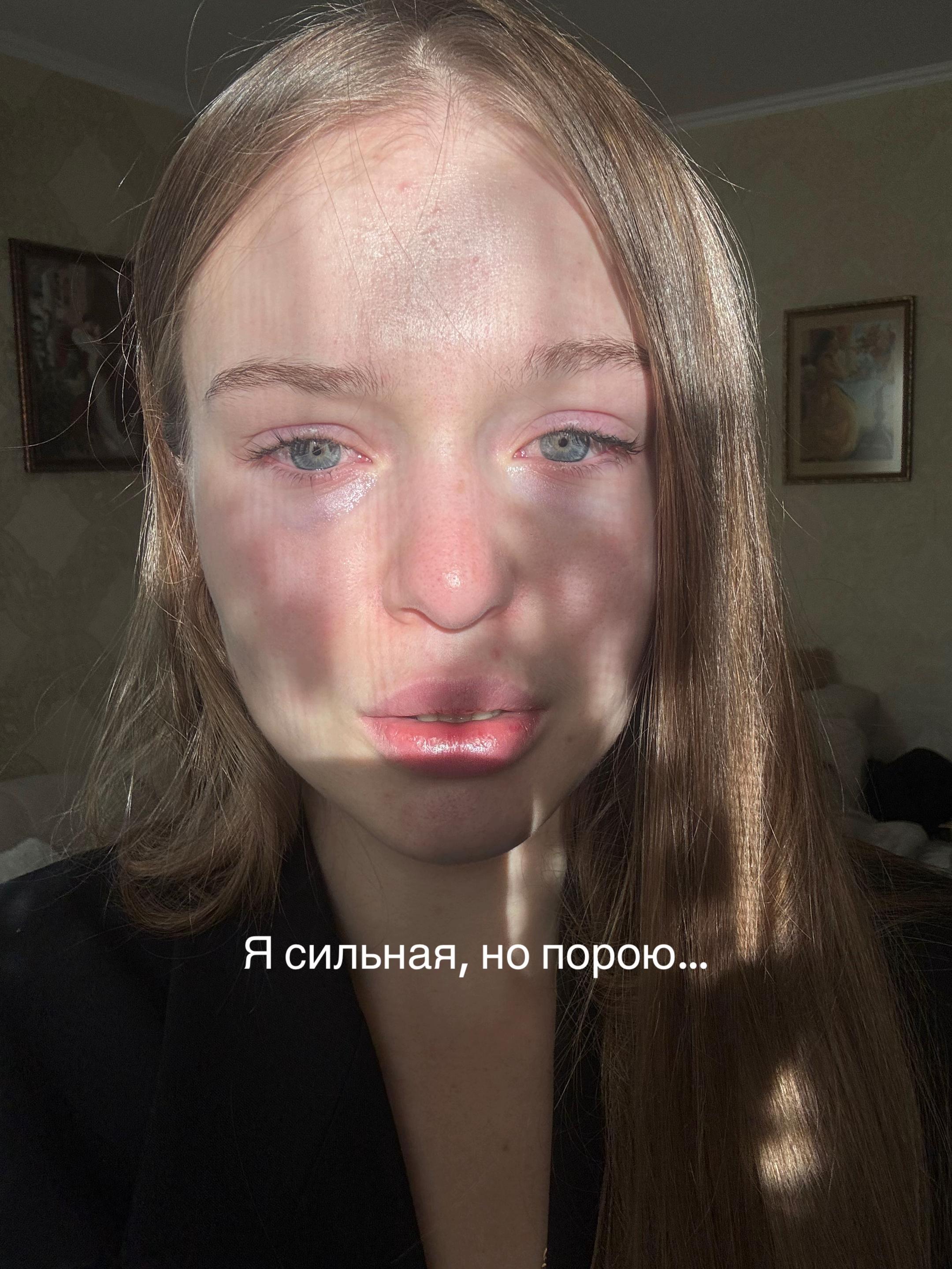 @Eleonora