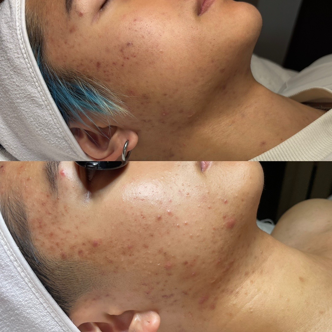@Julie Manko || Esthetician