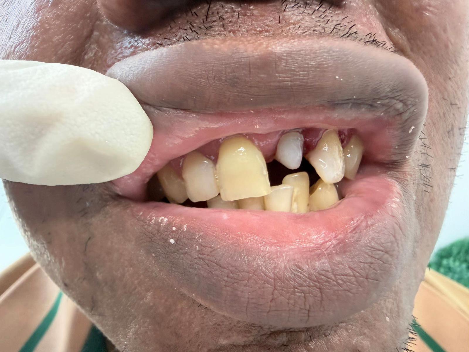 @InesDientes1