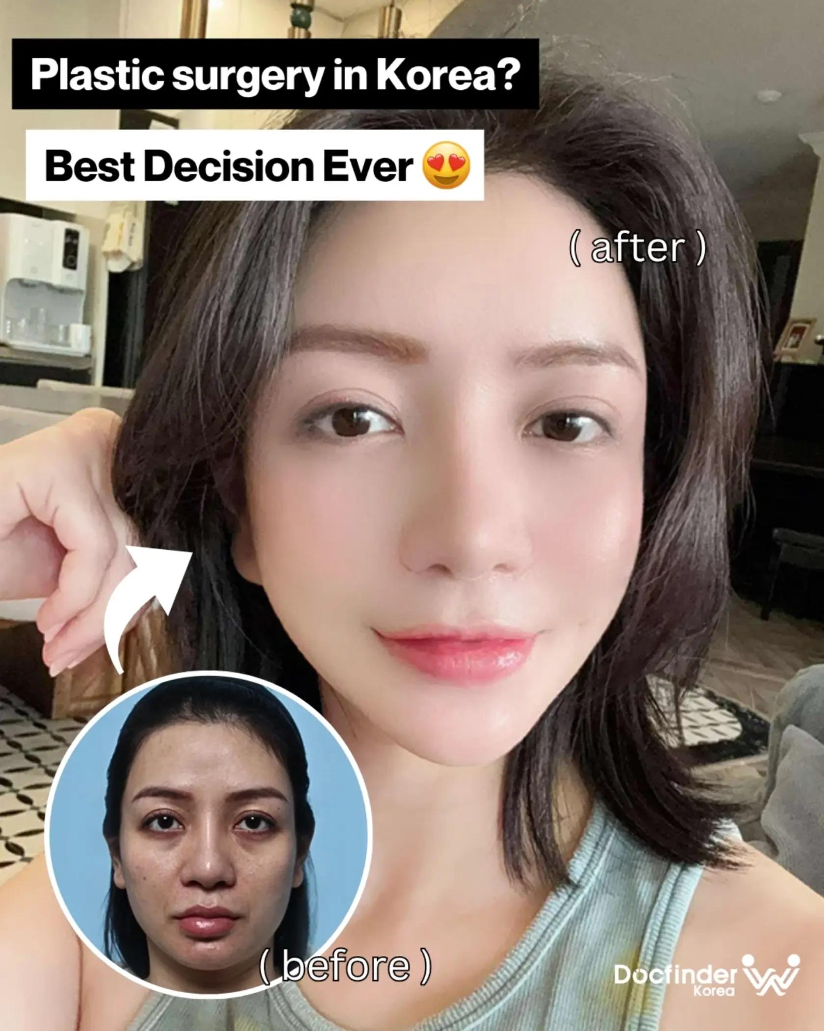 @Docfinderkorea