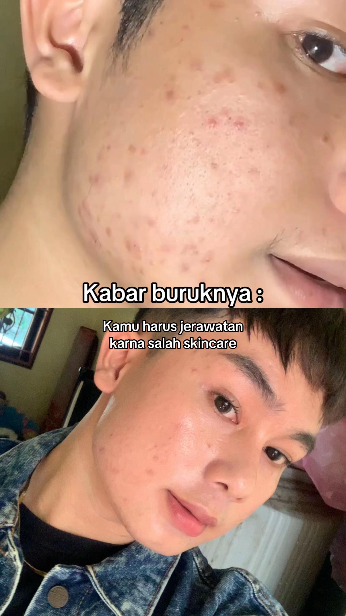 @Muekkk