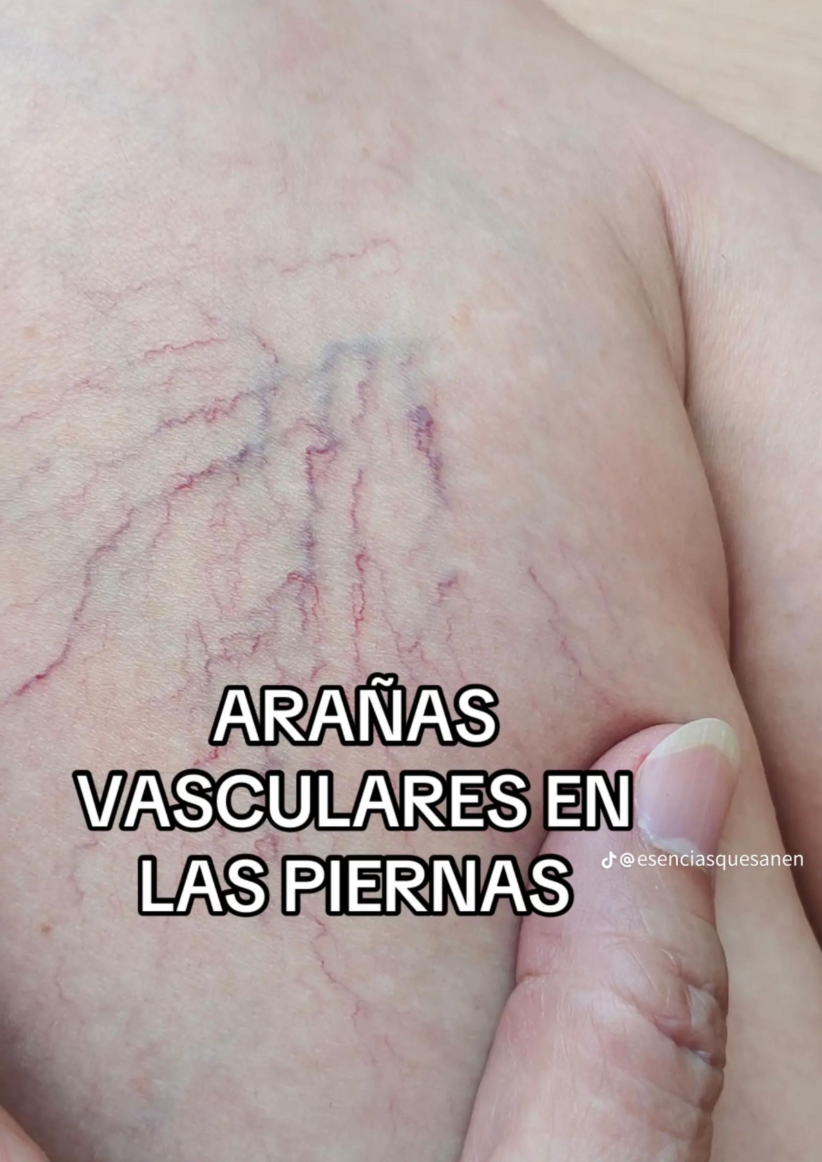 @limpia_tu_sangre