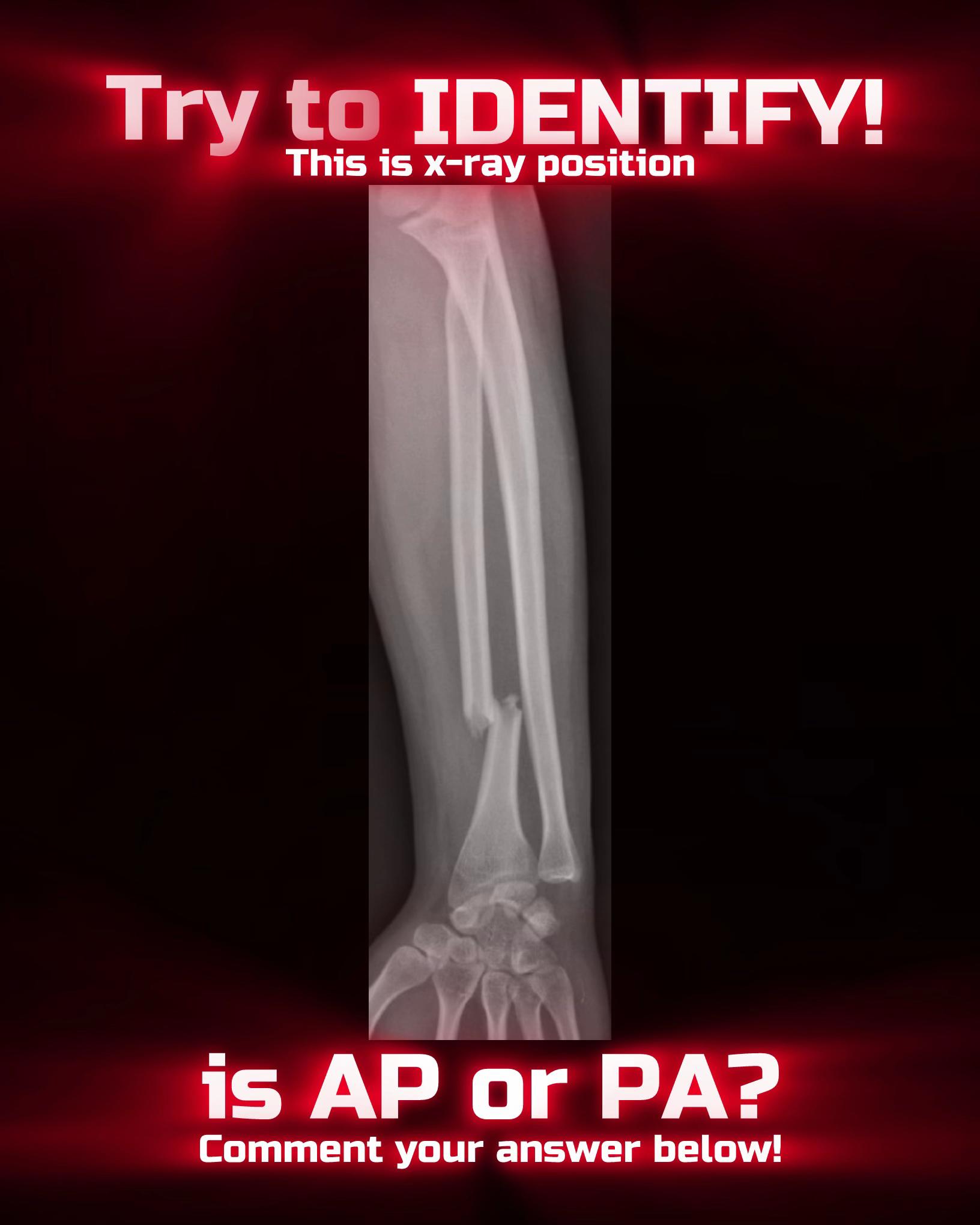 @Sobat Radiology