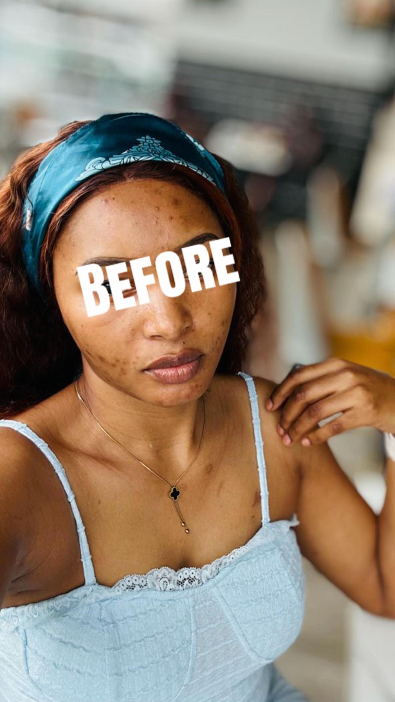 @Bornbeaute skincare