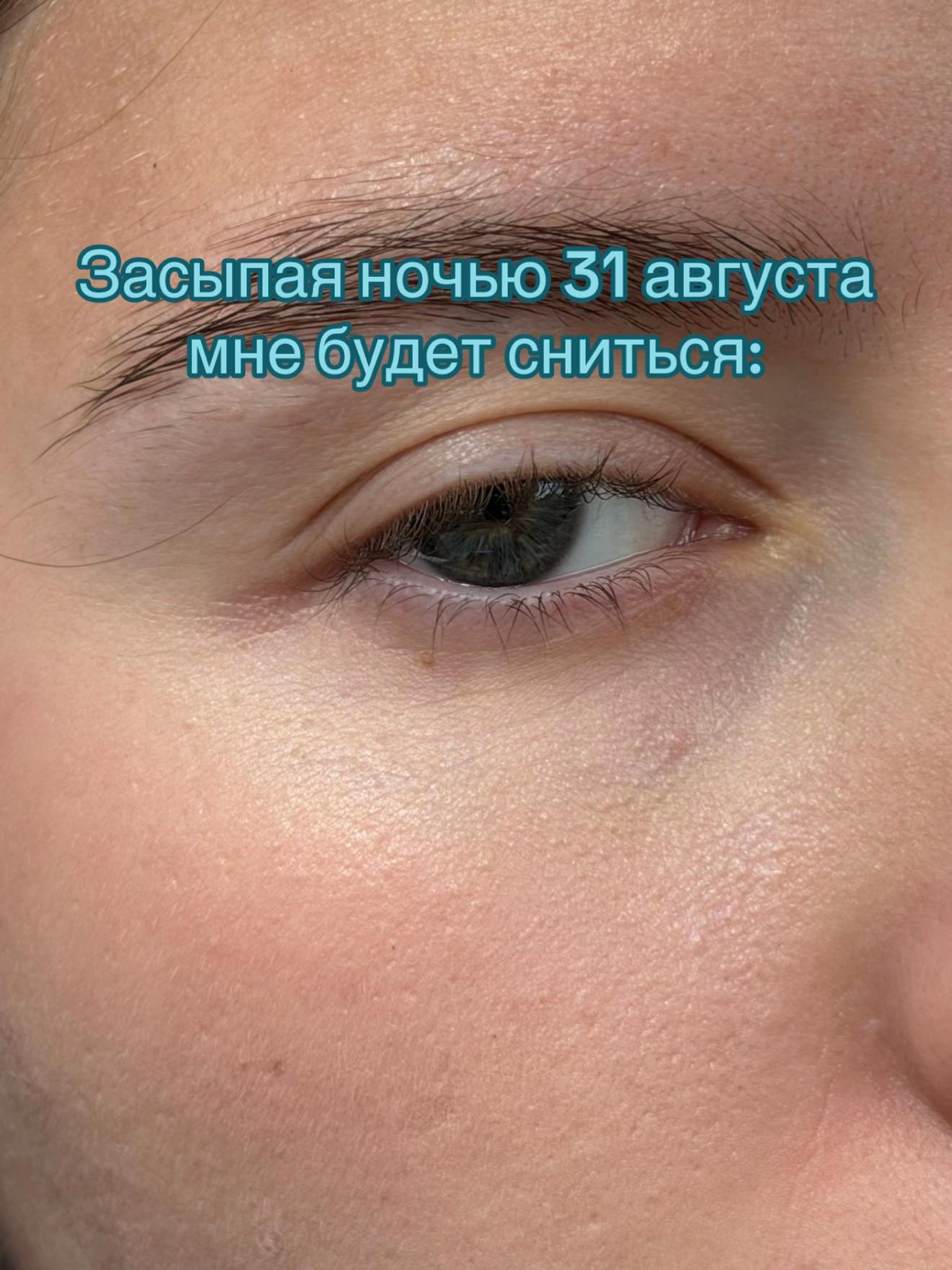 @YM