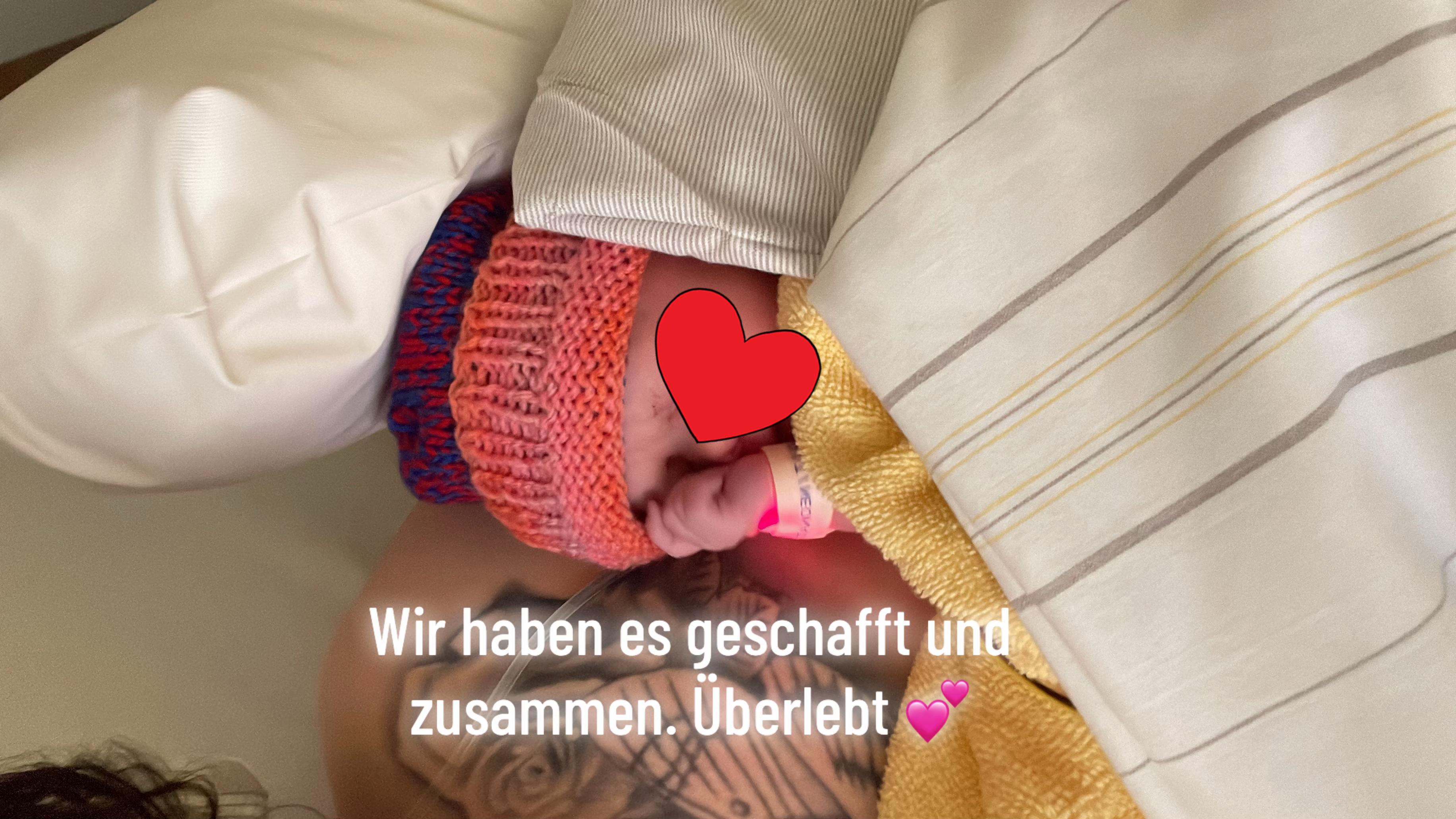 @Anna
