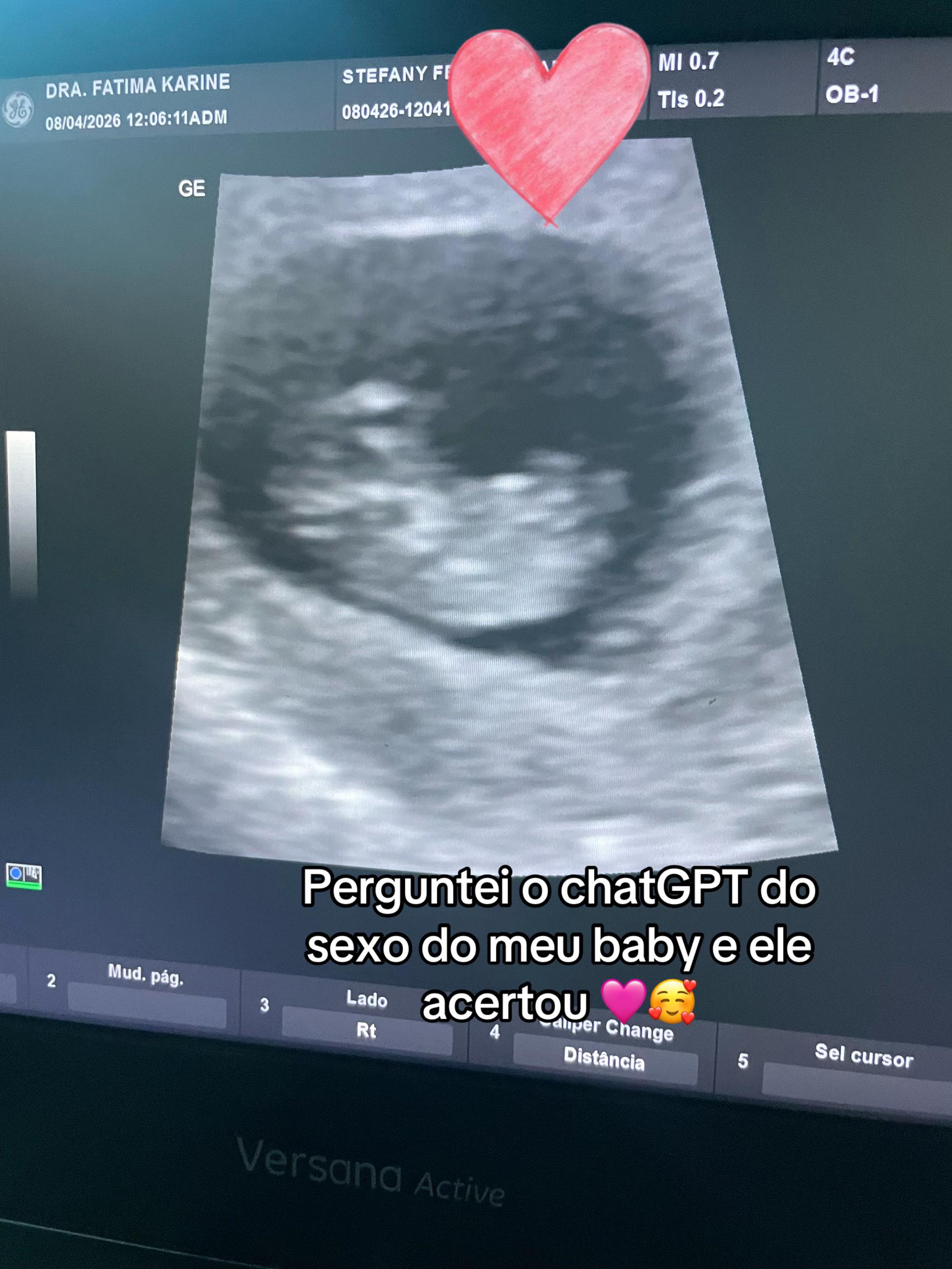 @Stefany Felix
