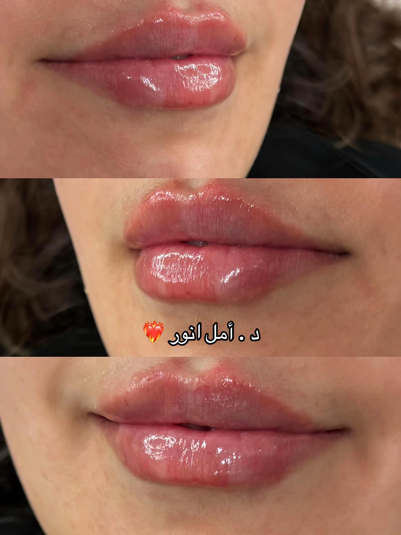 @مركز مزدانه 1 ( فرع الصحافه )