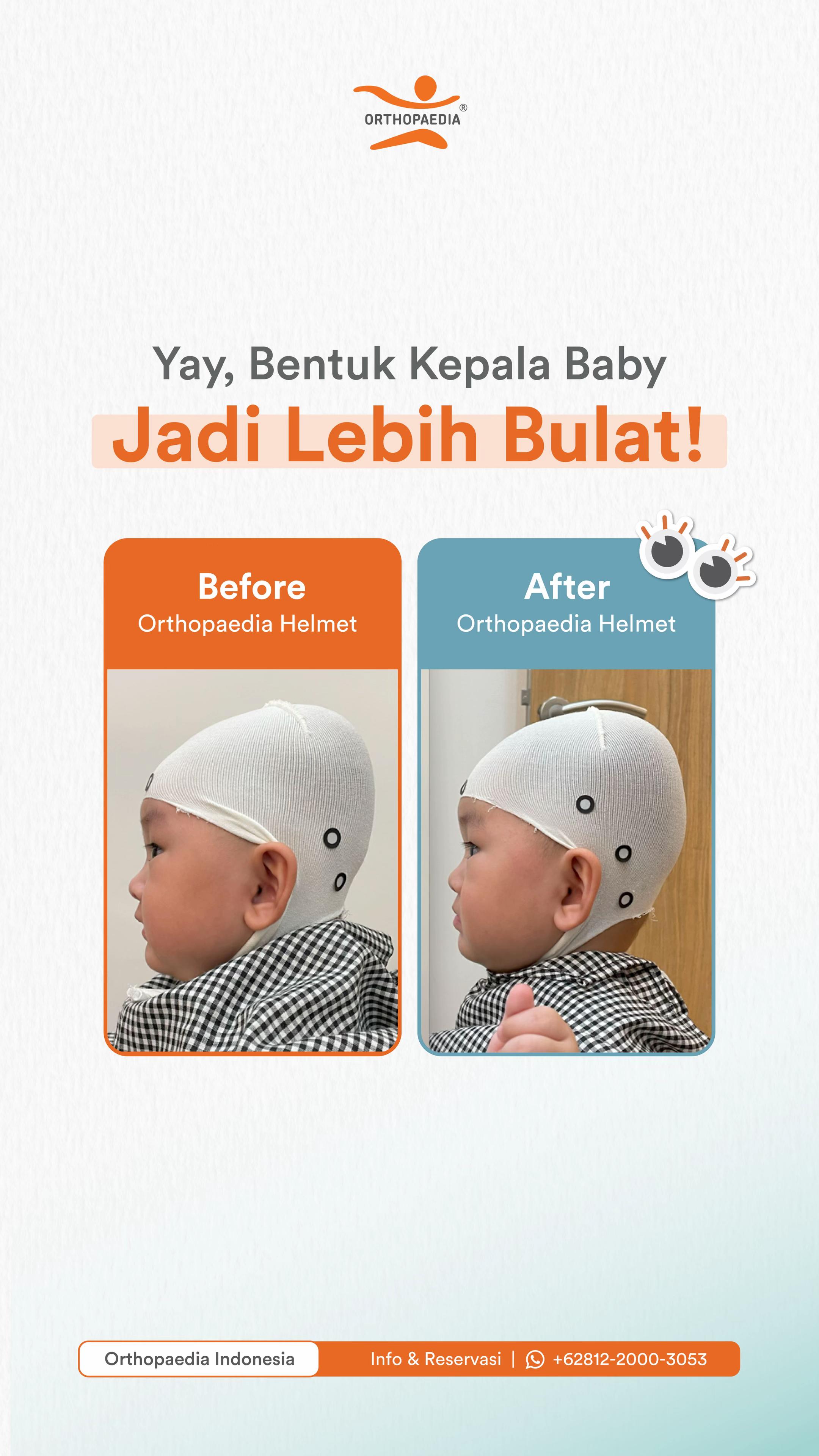 @Orthopaedia Indonesia