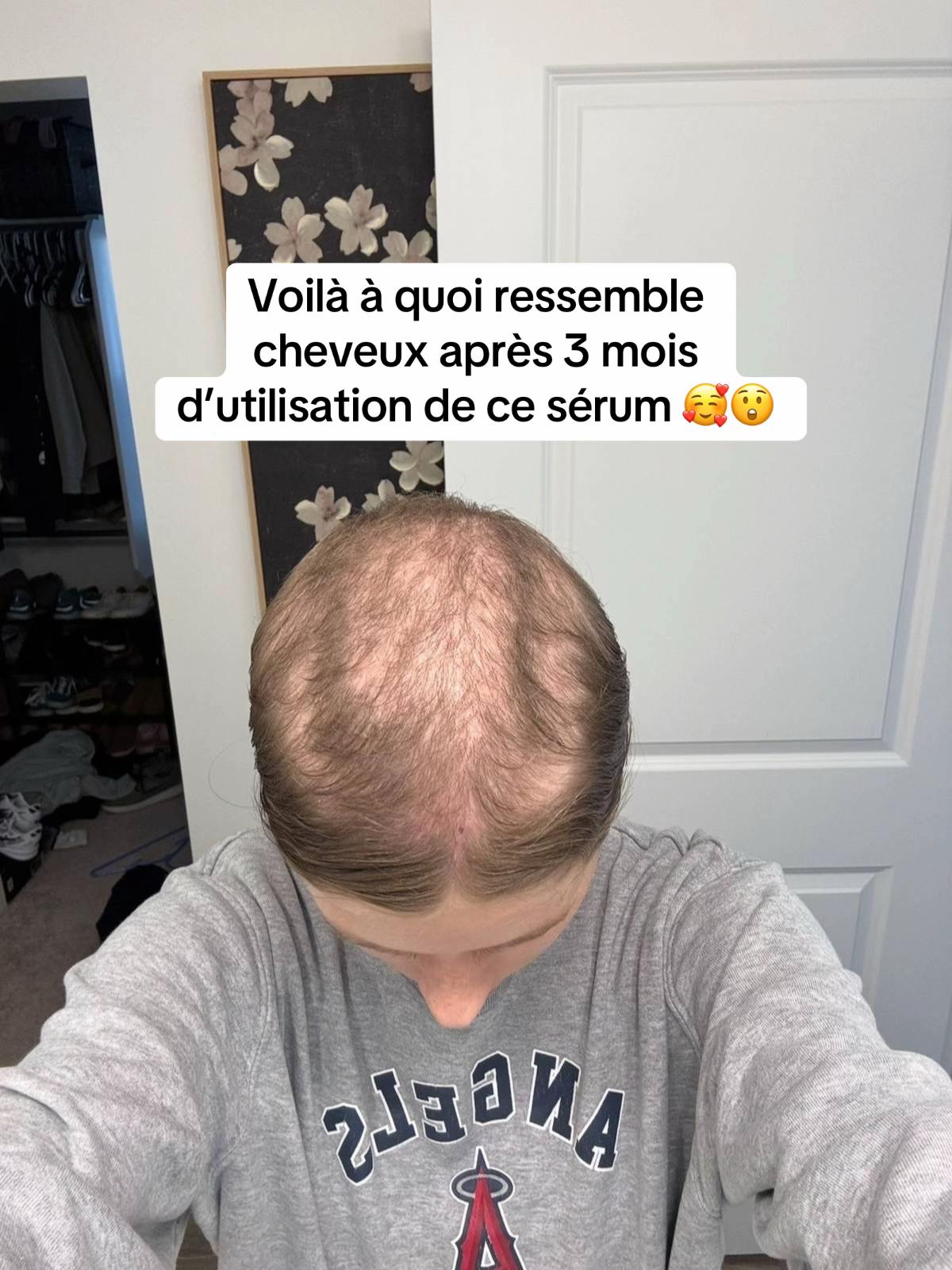 @Lux’Hair Growth FR