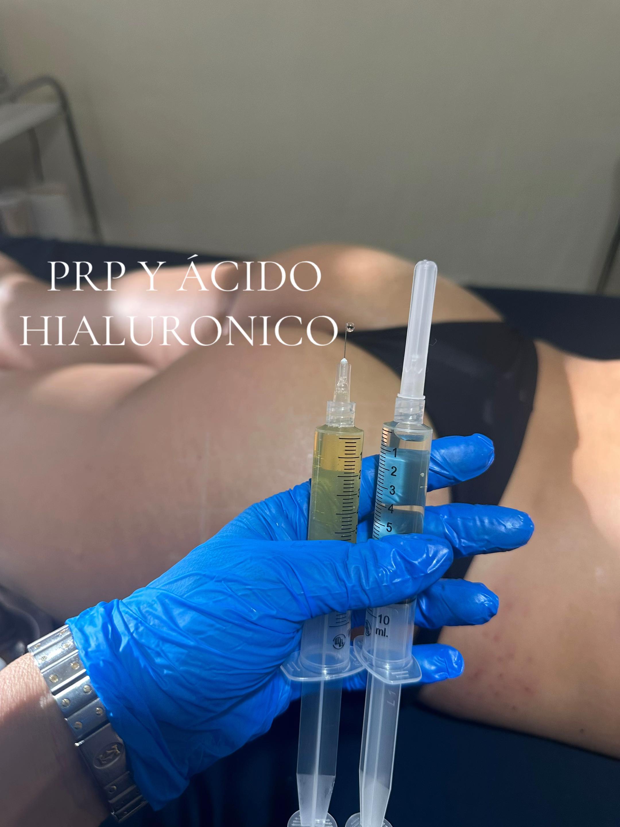 @pilhy gaenza