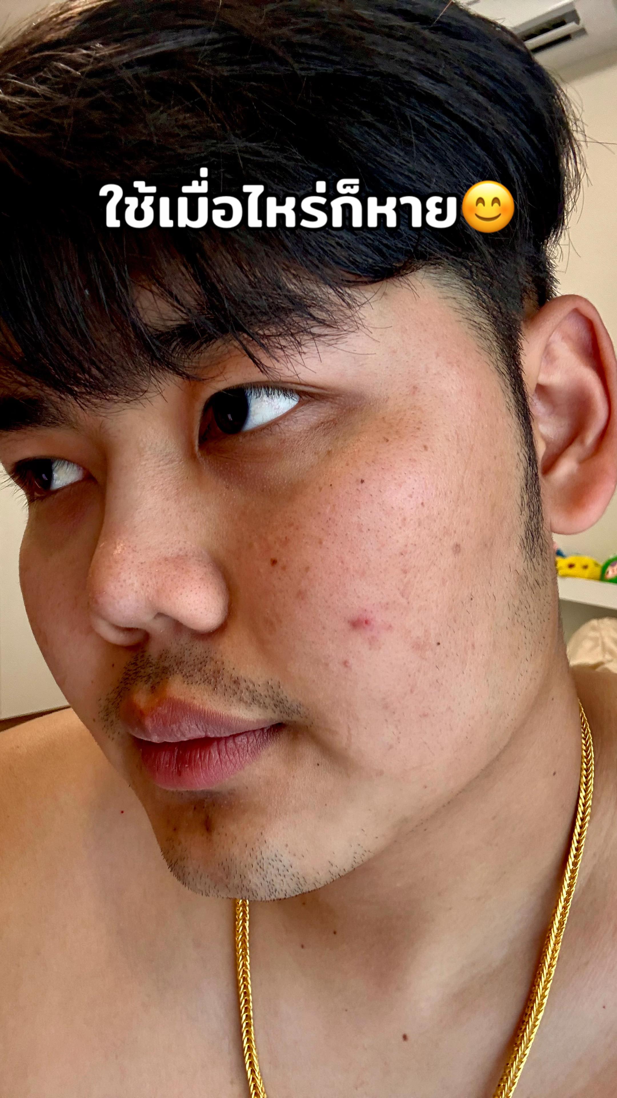@ณัฐพล ไนท์