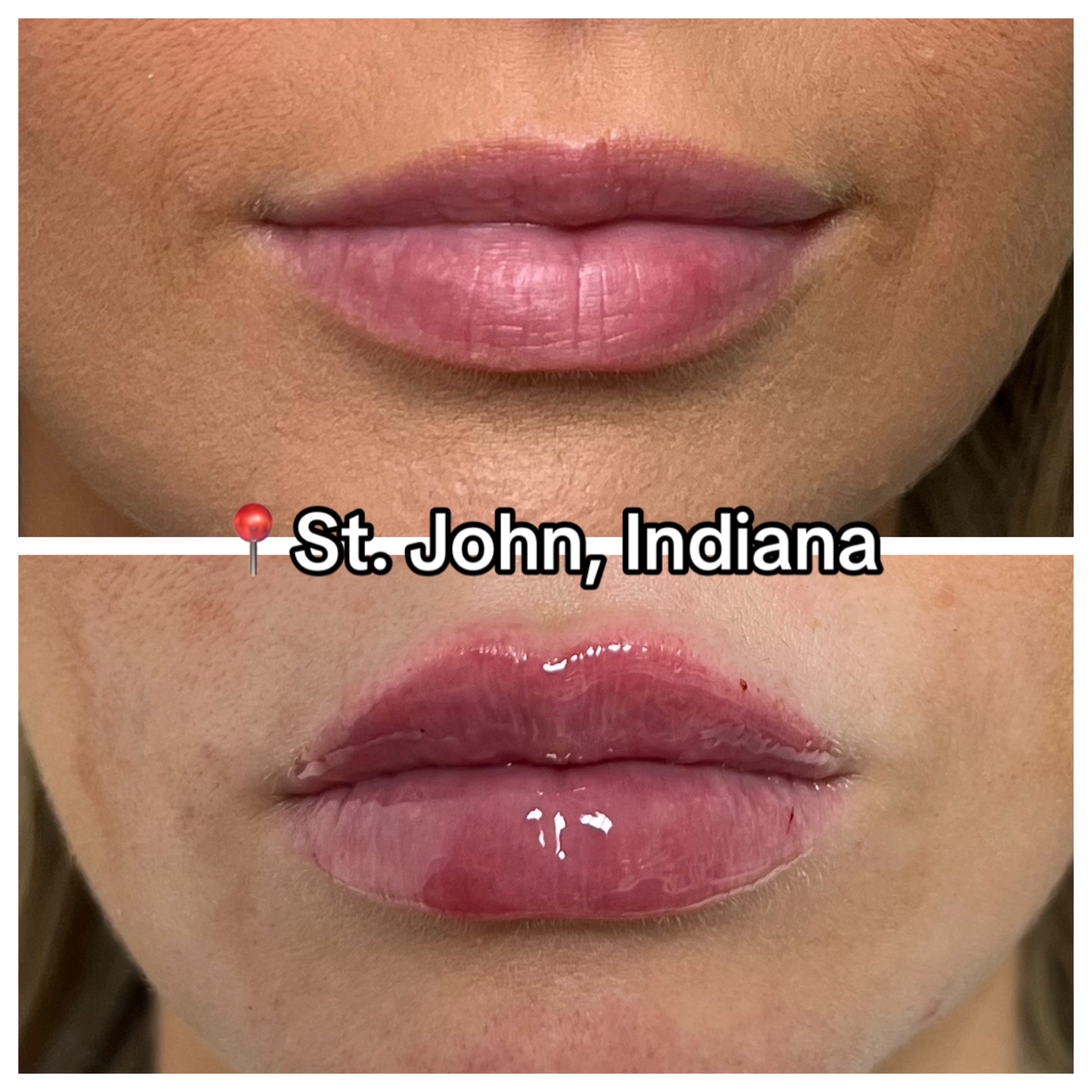 @Christy - NWI Aesthetic NP