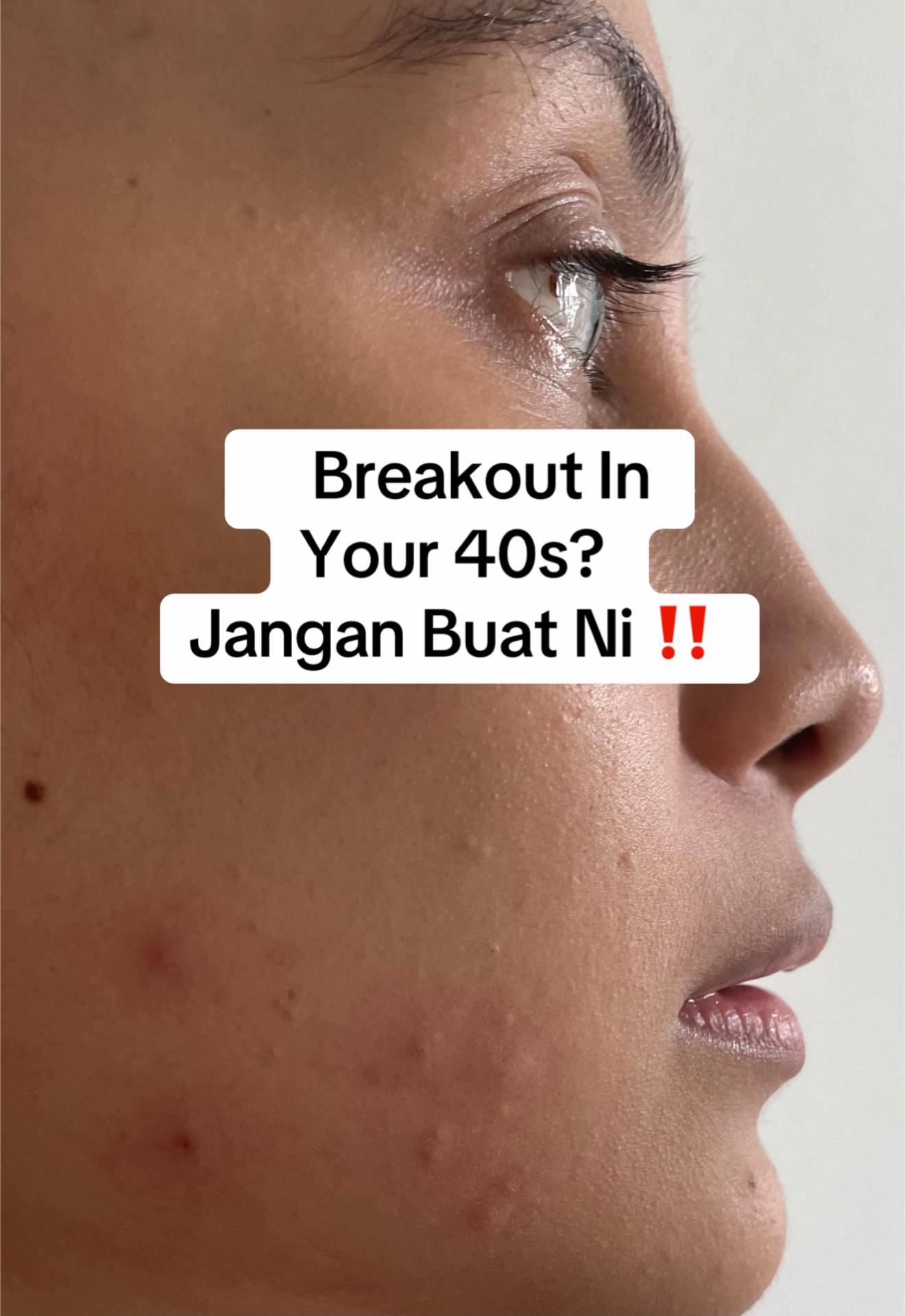 @Uyun Kamaruddin