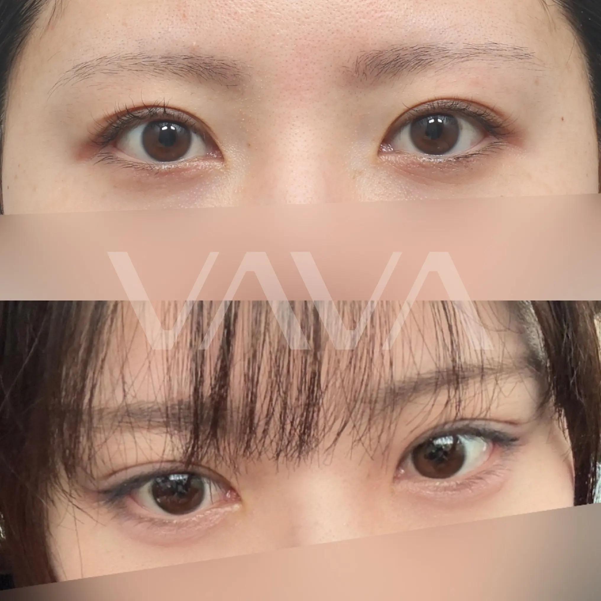 @VAVA美容整形外科
