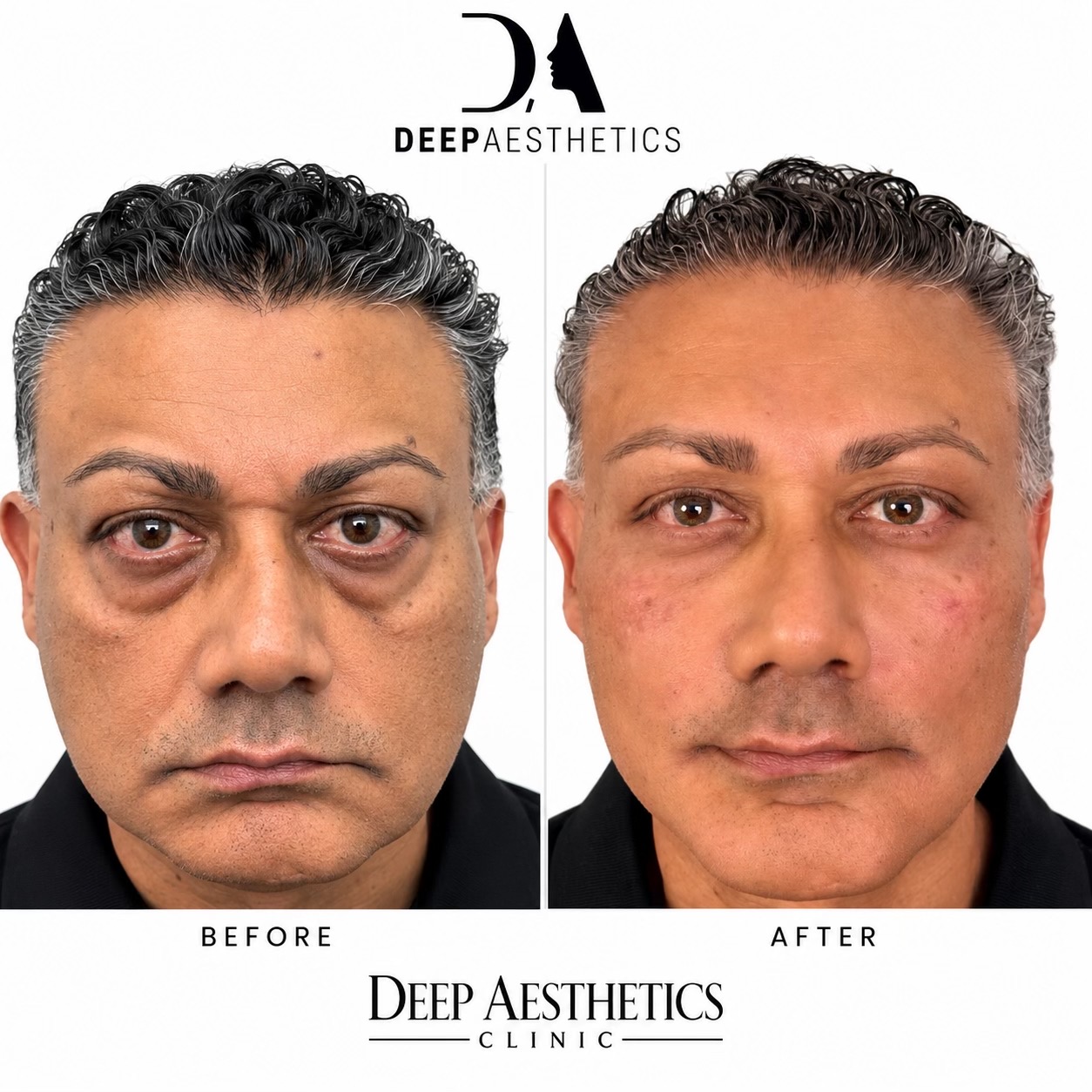 @deepaesthetics_official