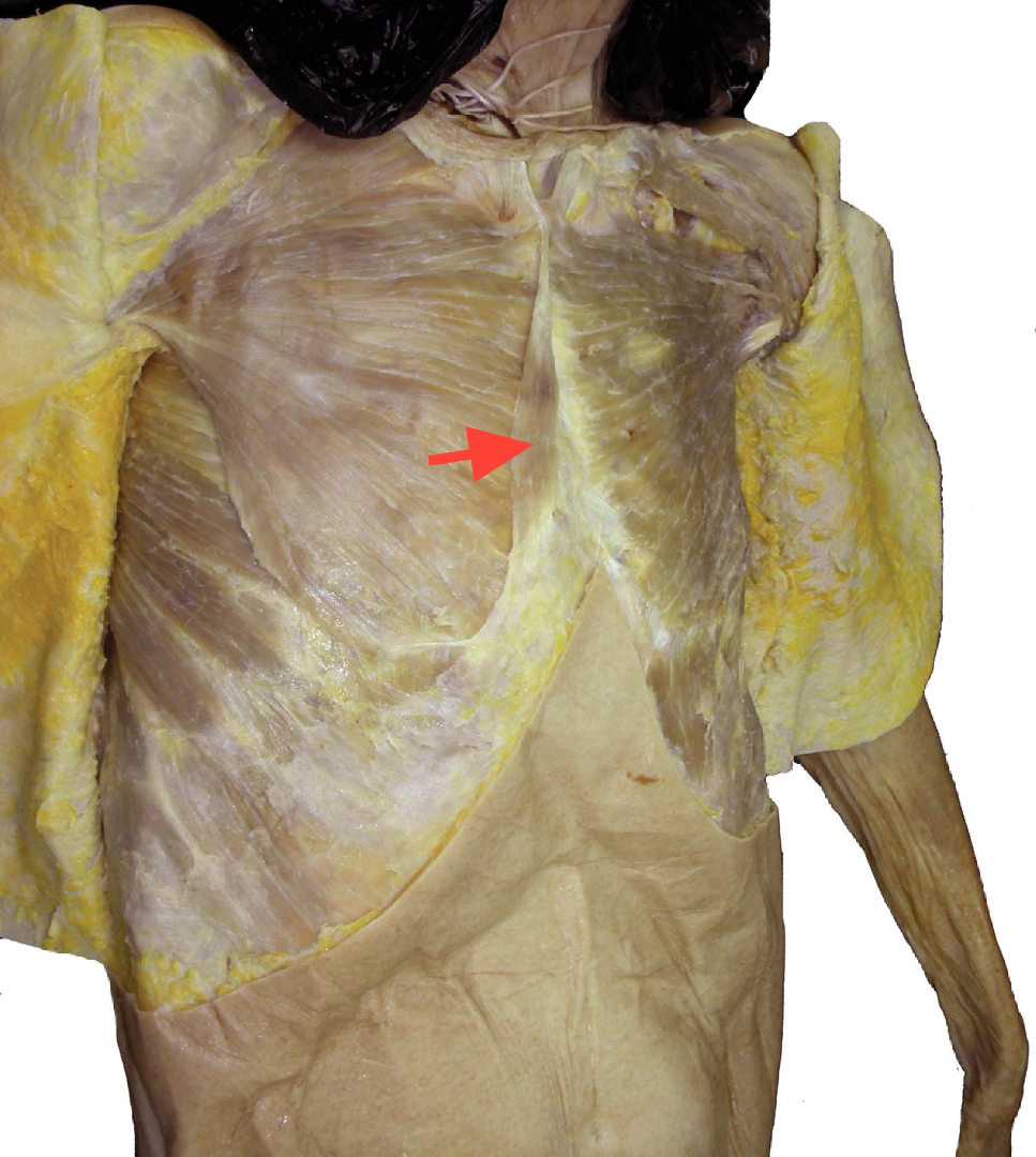 @Pasi&oacute;n por la Anatom&iacute;a