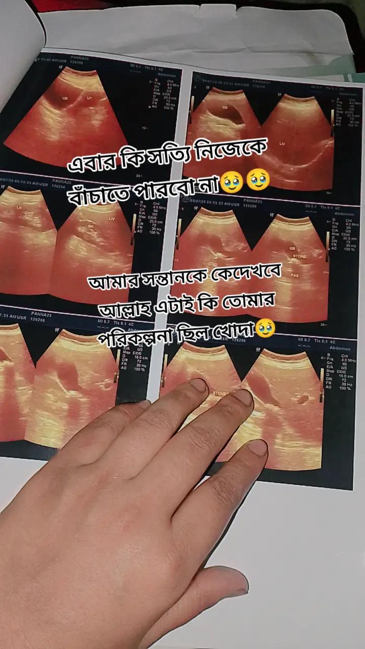 @đ§đĨāĻāĻžāĻāĻĻāĻĒā§āϰā§āϰ āĻŽāĻžāϰāĻŋāϝāĻŧāĻž đĨđ§