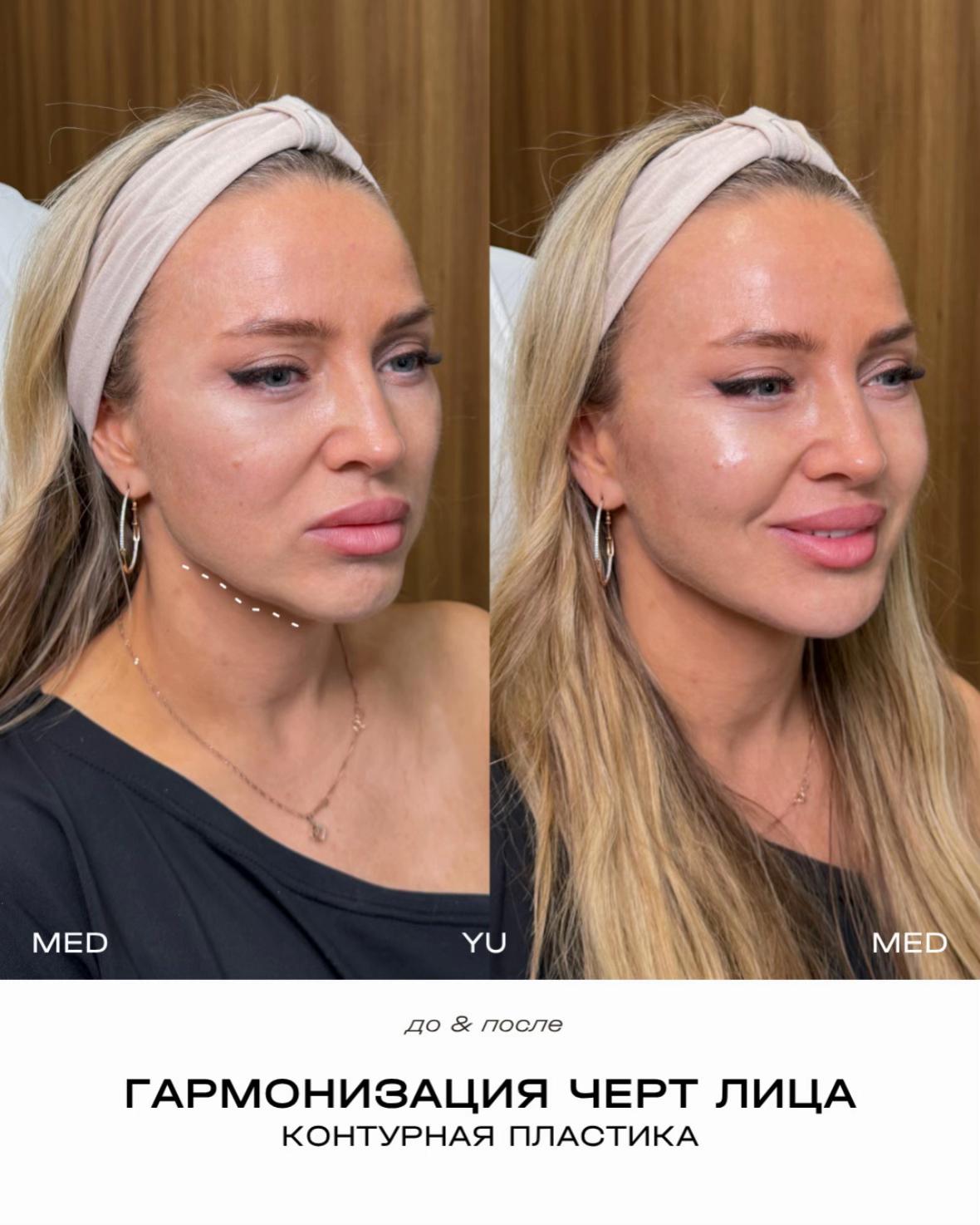 @MED YU MED