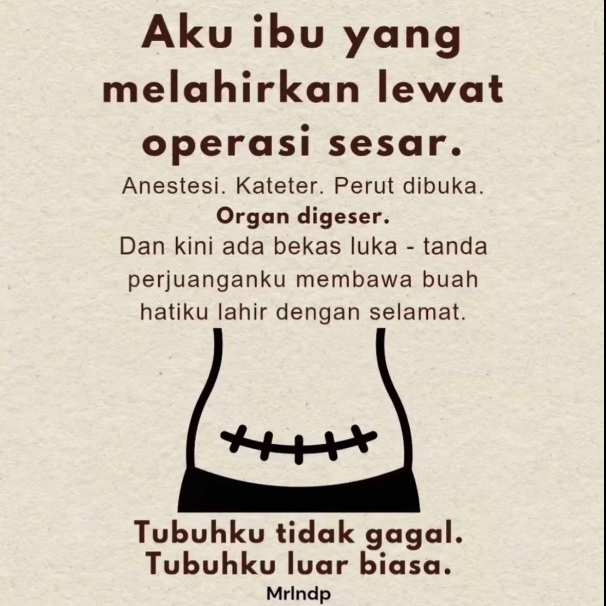 @Baby A
