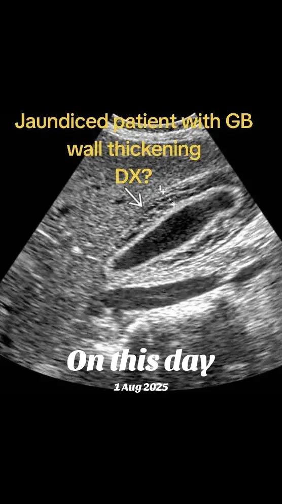 @Dr Wubie Endalew(Radiologist)