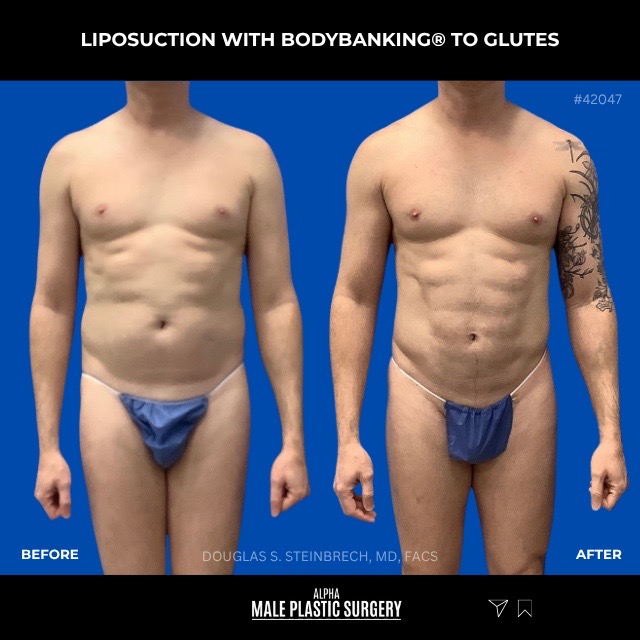 @mensplasticsurgery