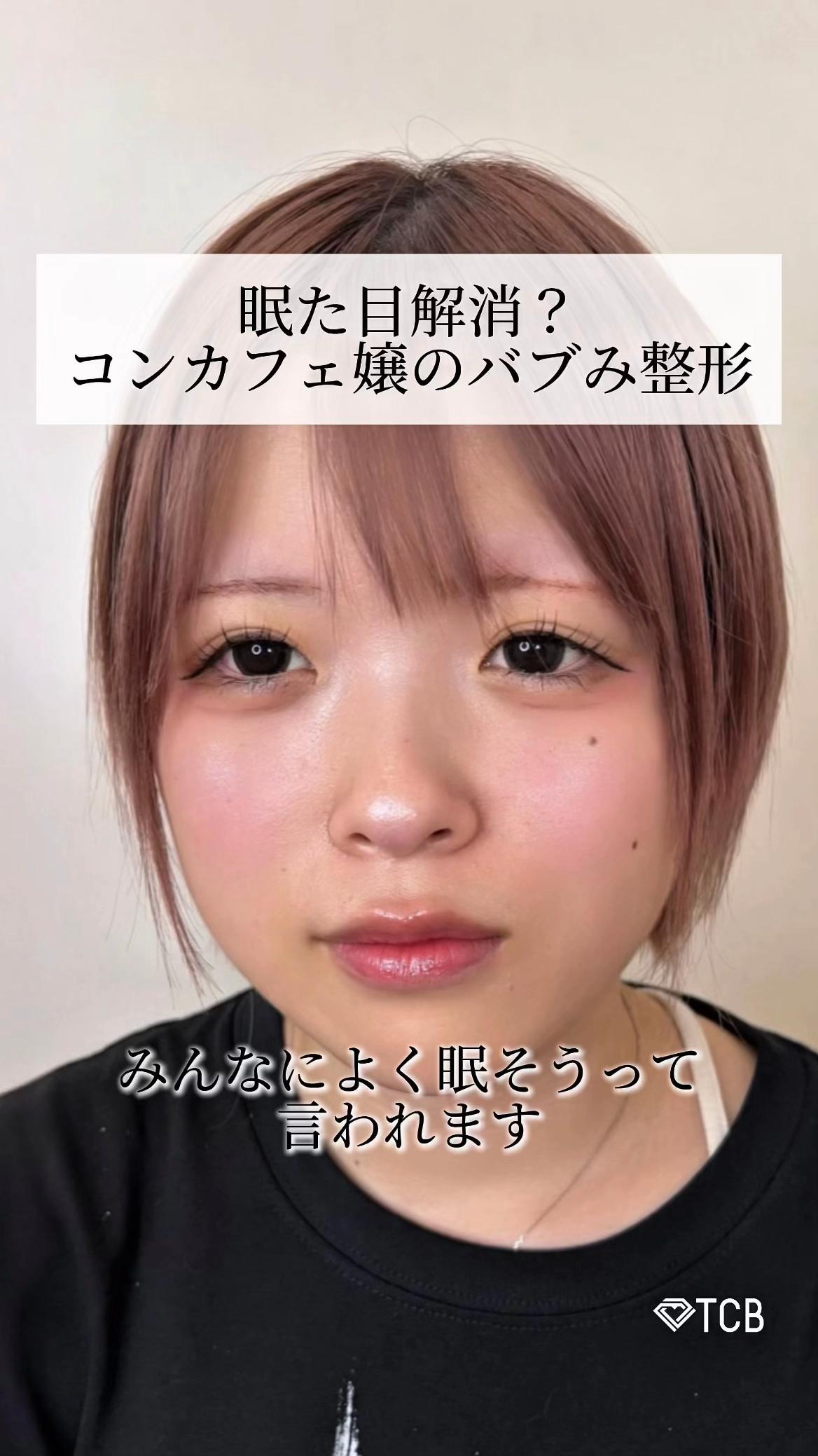 @【二重整形】TCB 新宿東口院ゆいこ先生/東京