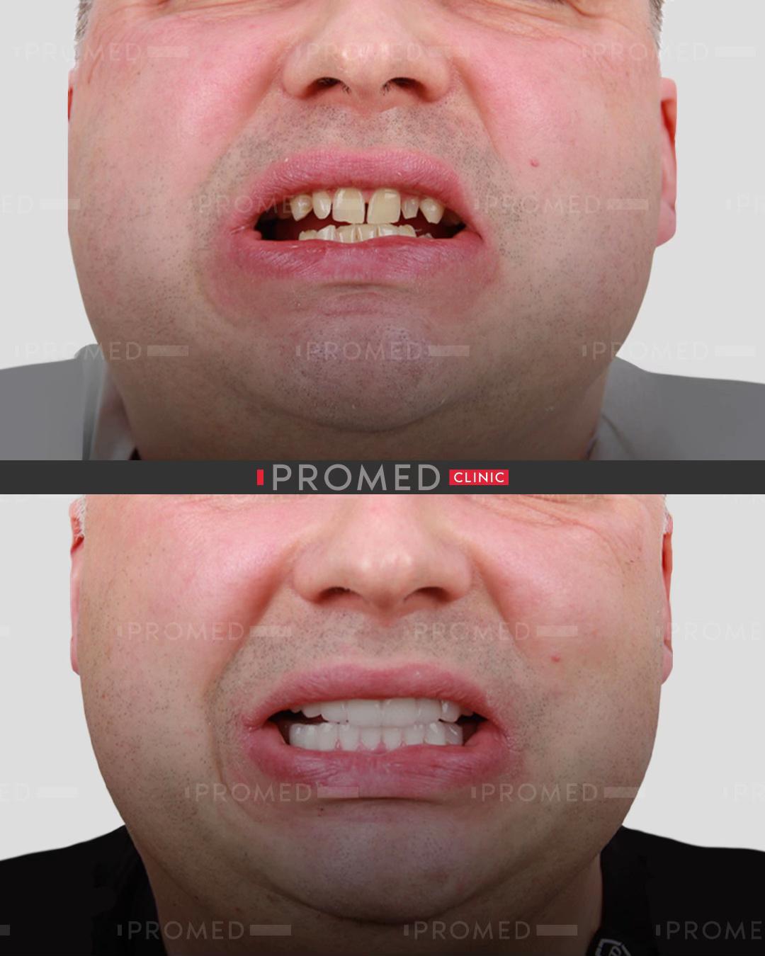 @promeddentalclinic
