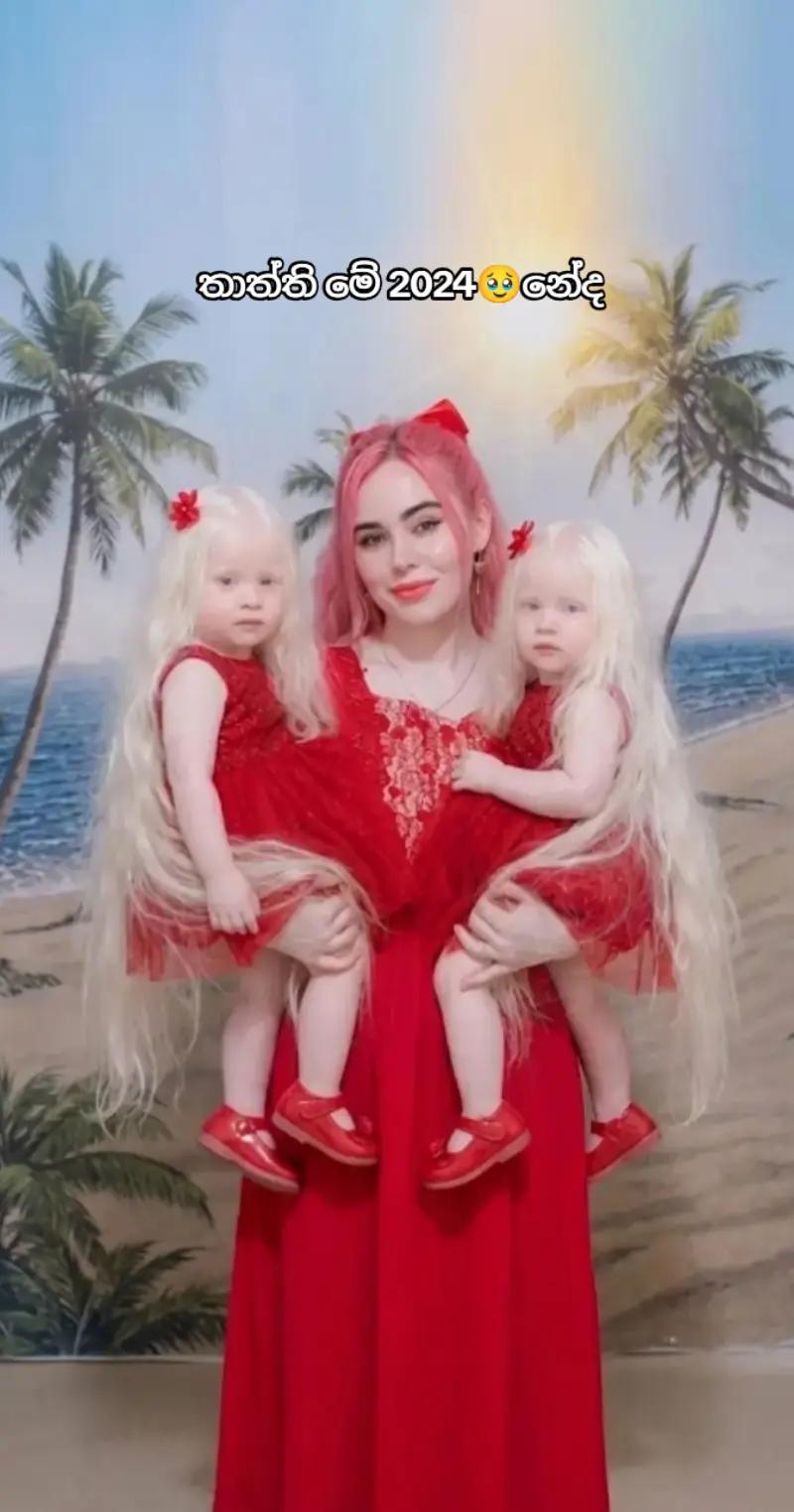 @🧝🤍Albino Girl LK🤍🧝🩵