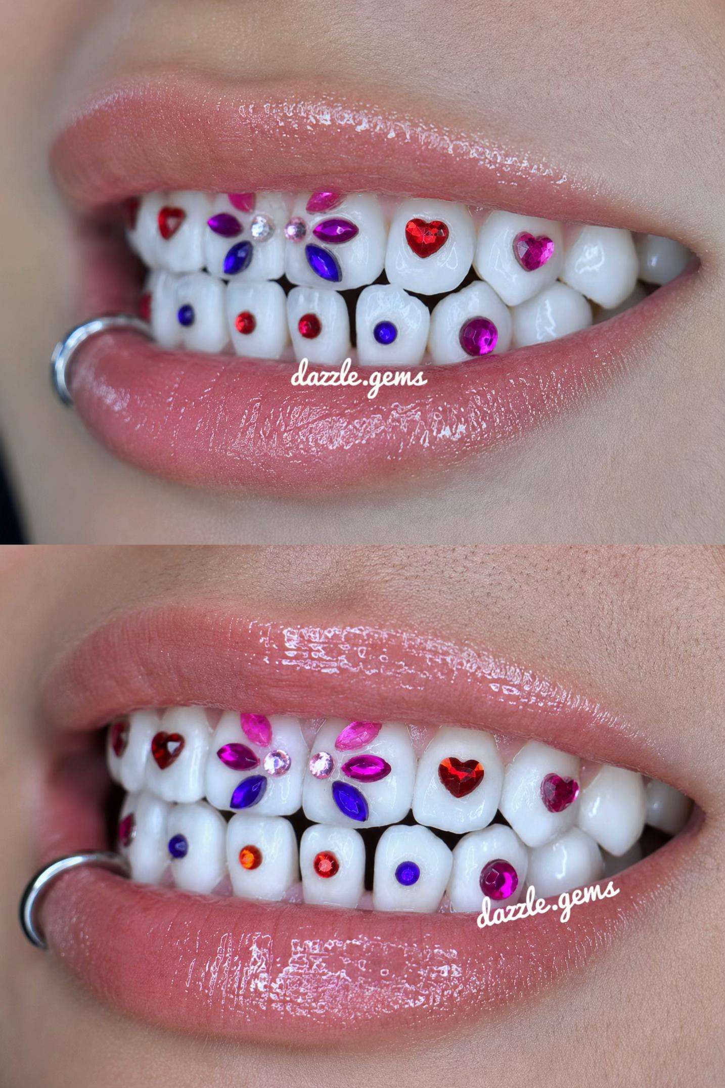 @Piercing - Toothgems