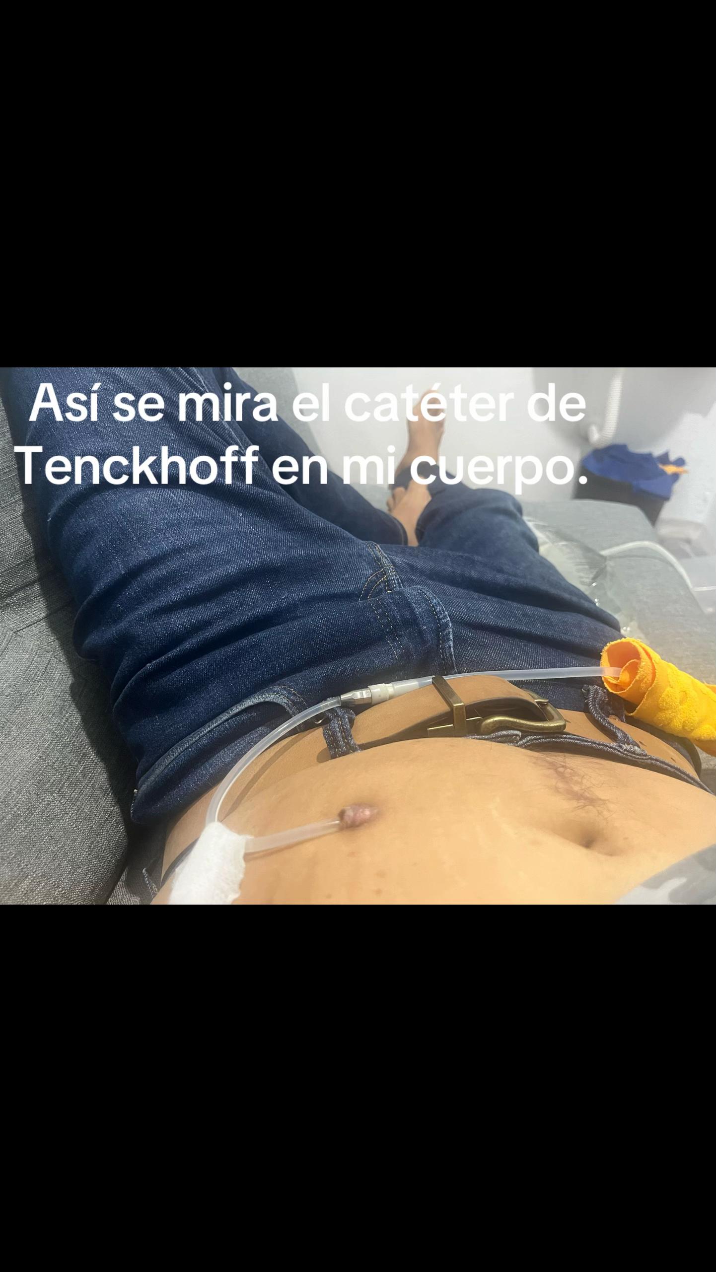 @Jes&uacute;s G. Becerra