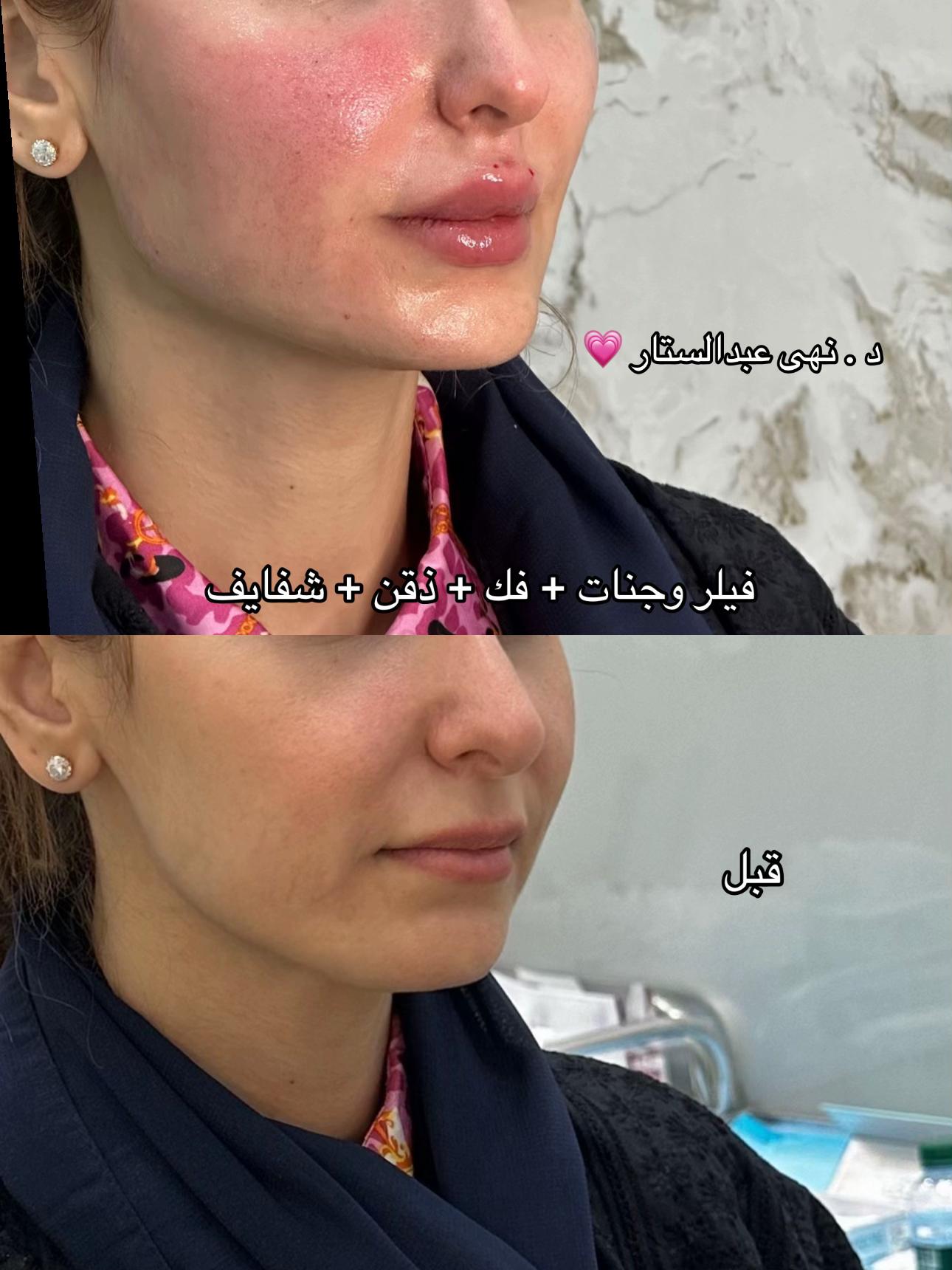 @مركز مزدانه 1 ( فرع الصحافه )