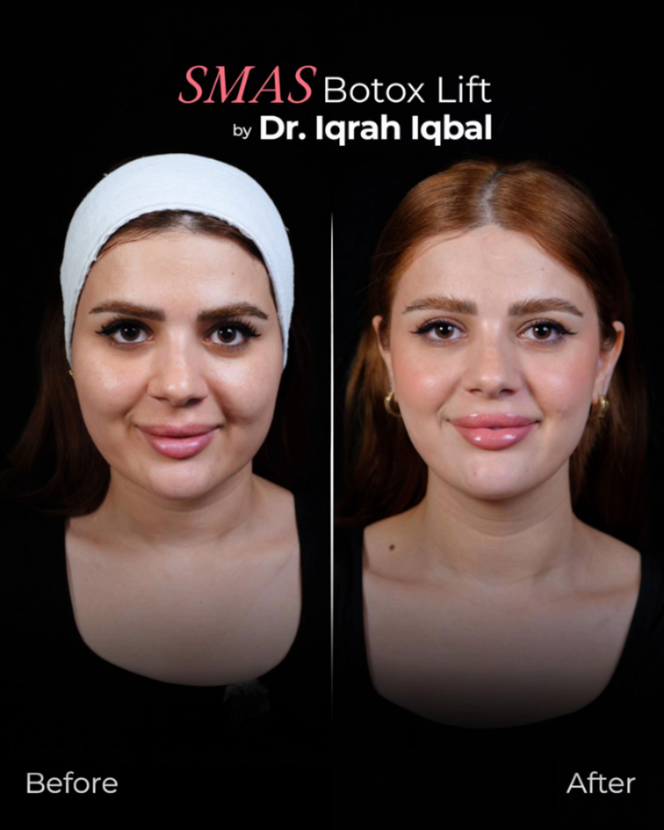 @Dr.Iqrah.Aesthetics