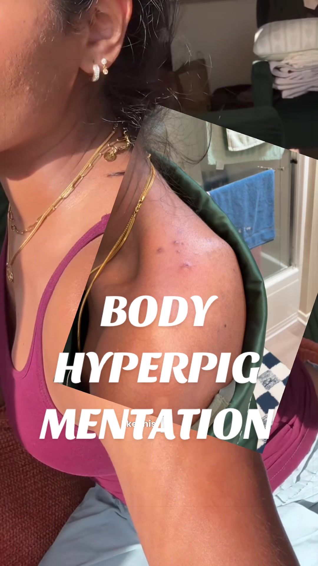 @Nyx Curations | Acne +Wellness