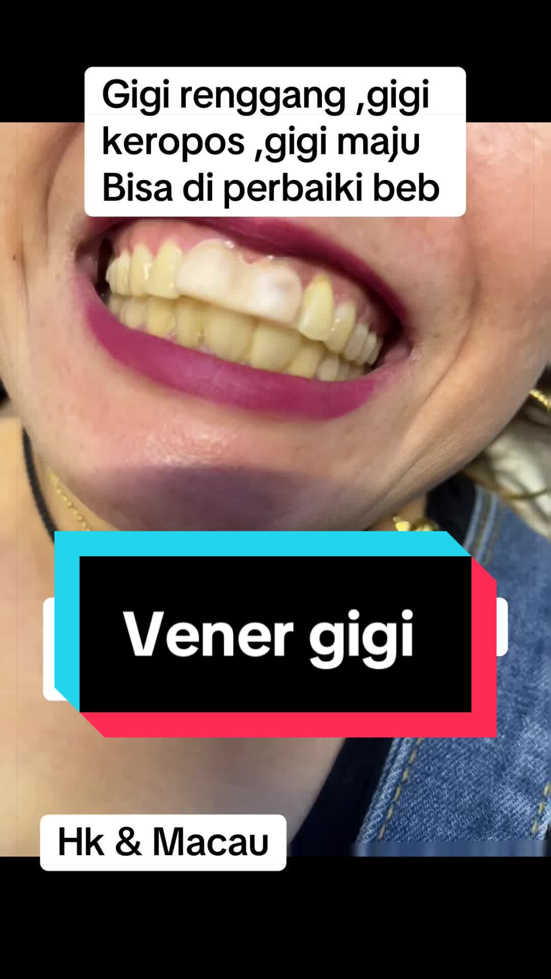 @mbak-Paijem