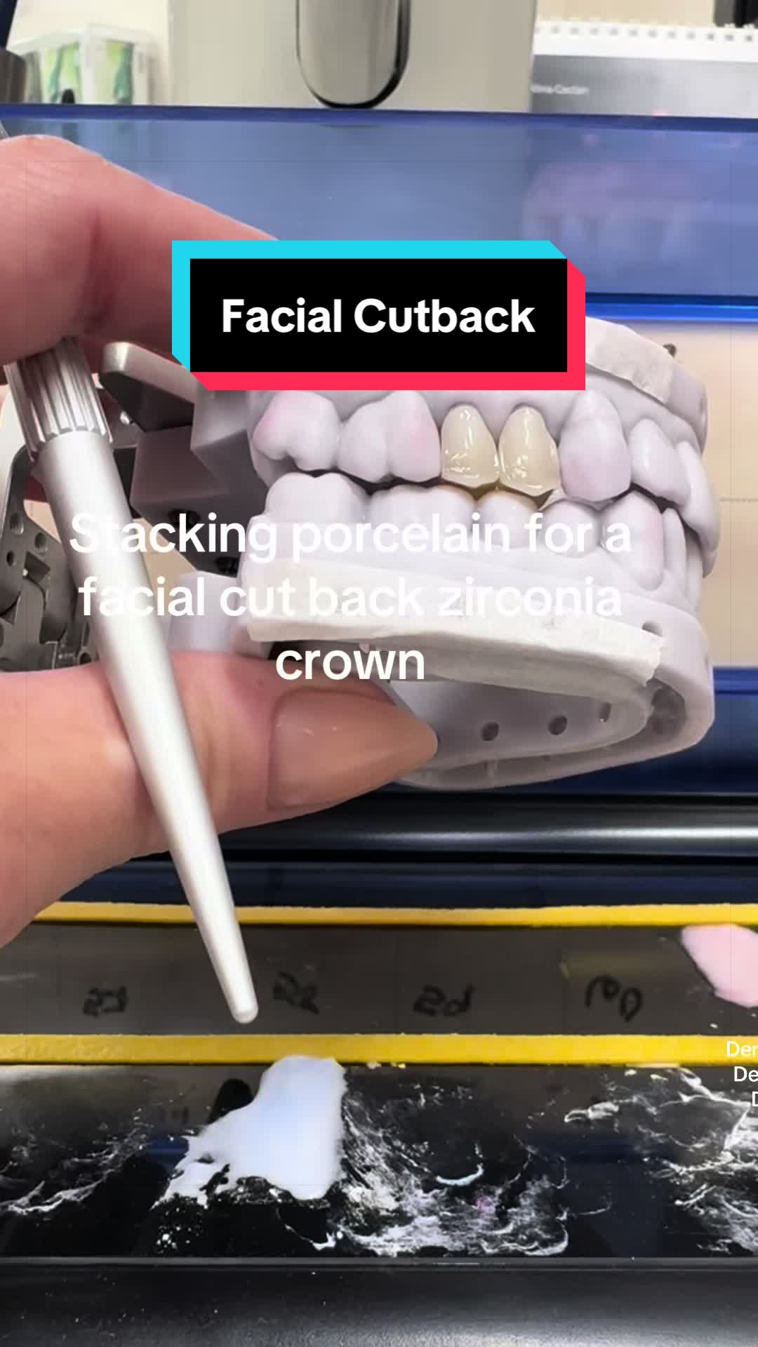 @Dental Tech Hey Jey