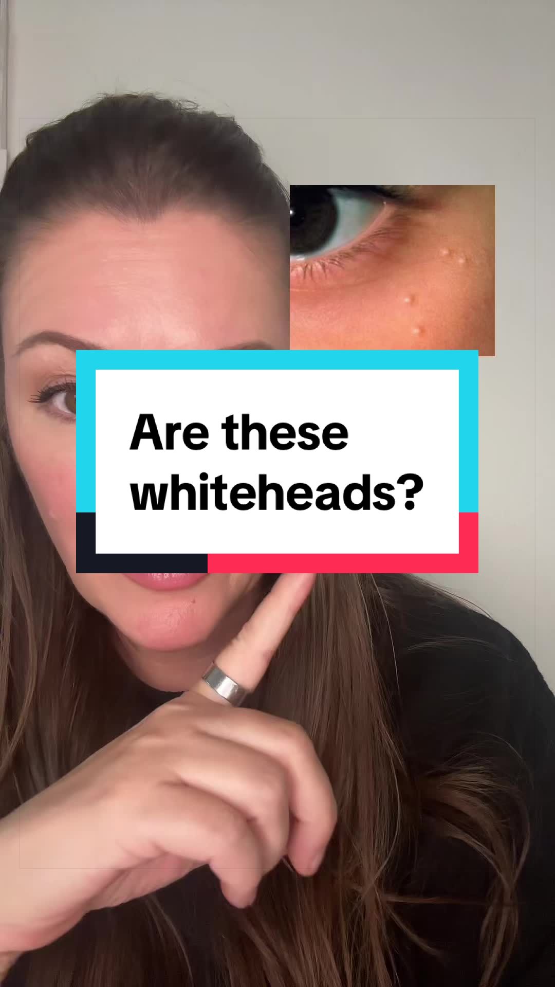 @Wendy