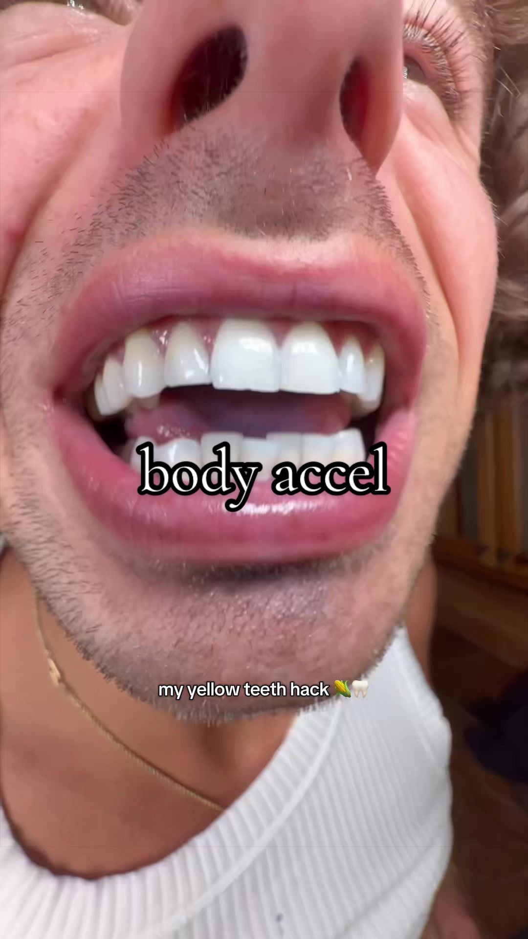 @mercercaiden