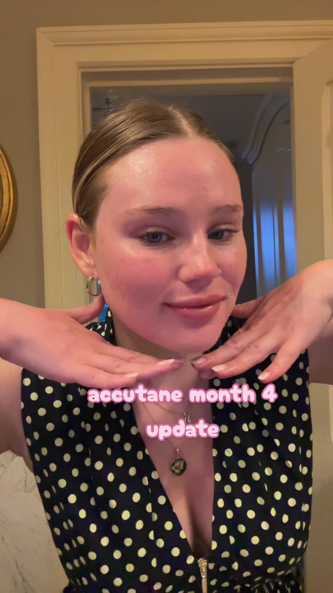 @Emily Ryan