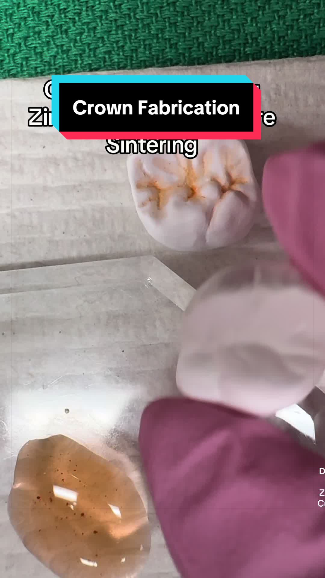 @Dental Tech Hey Jey