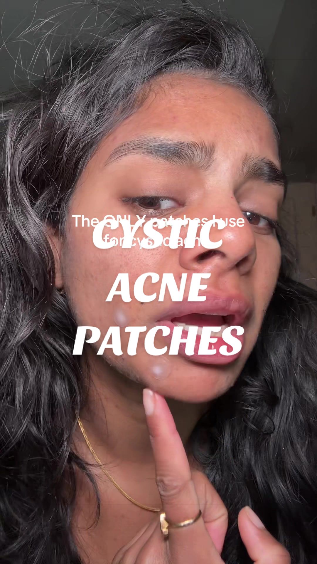 @Nyx Curations | Acne +Wellness
