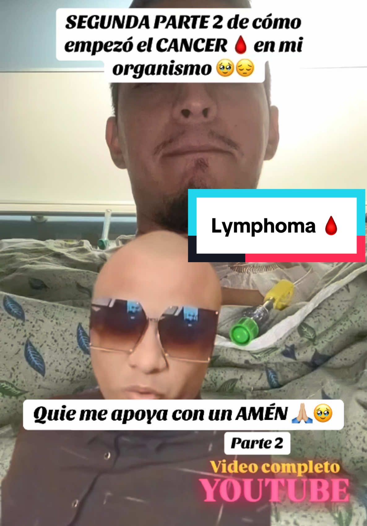 @Angel Gomez Linfoma