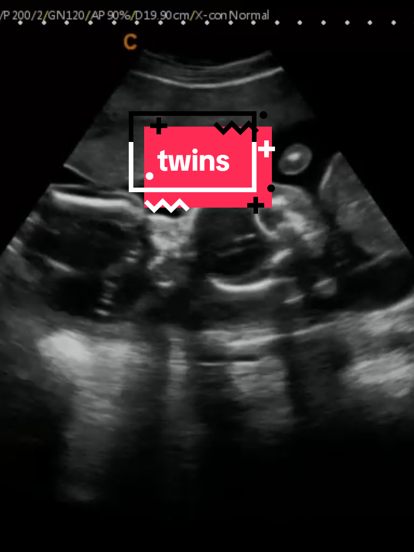 @Hey, Baby!