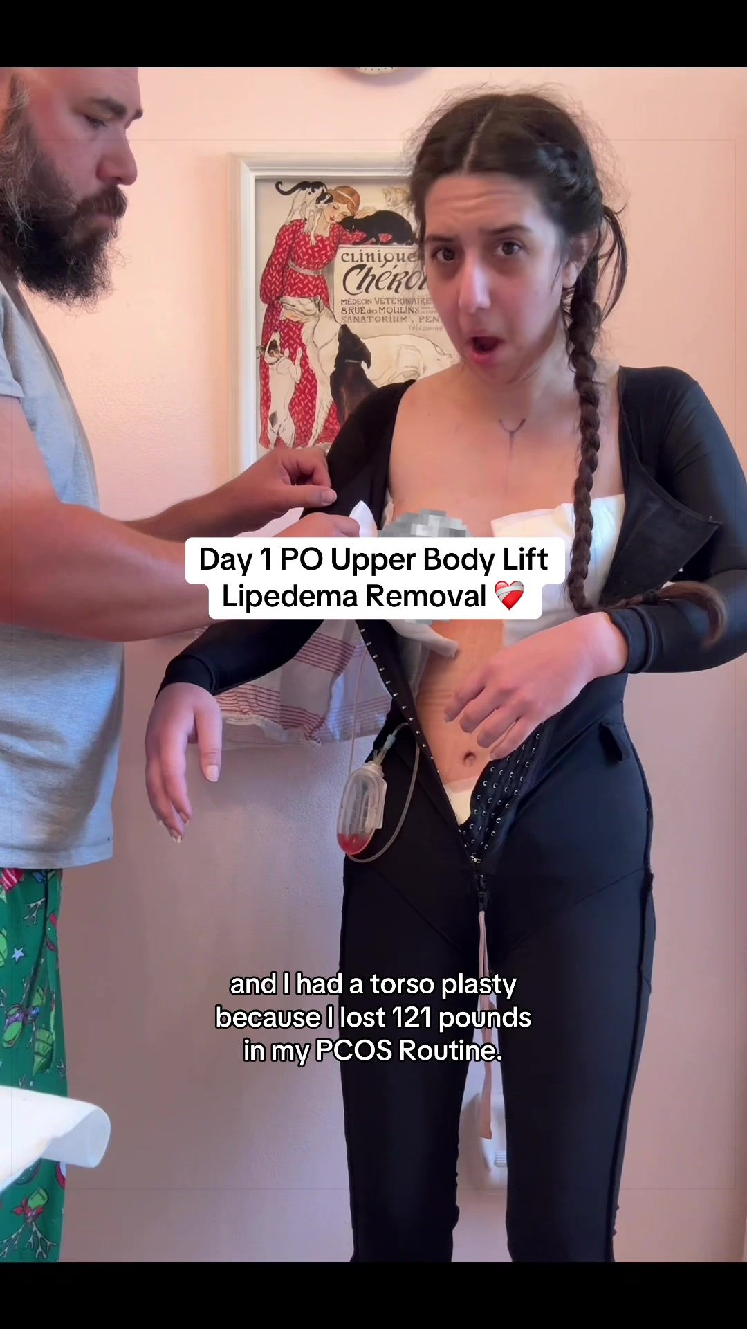 @Heather 𖤓 PCOS Princess
