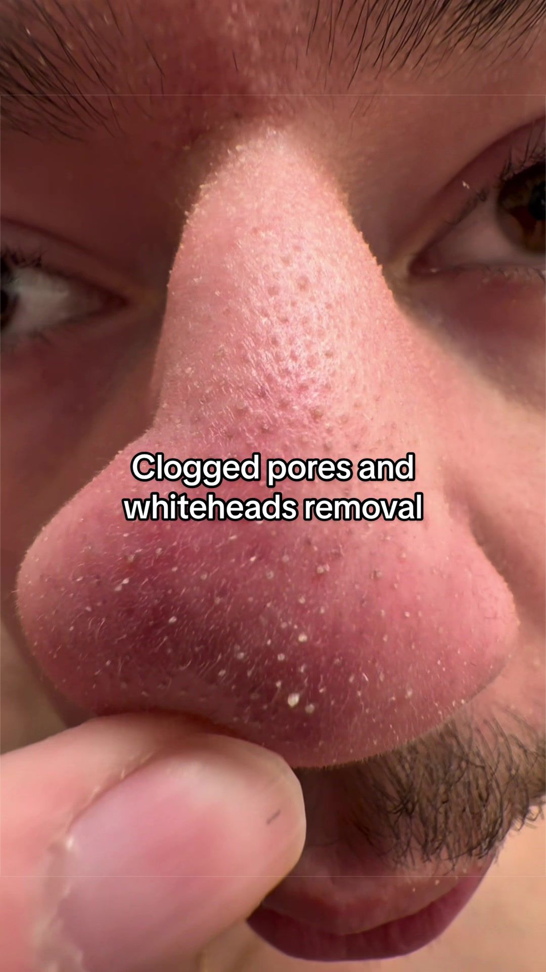 @Logan Walter