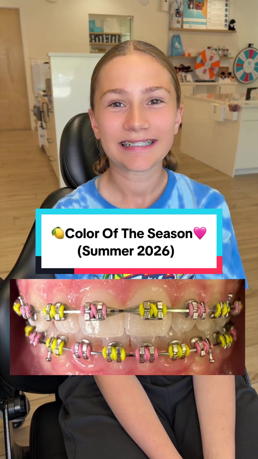 @Braces Survival Guide