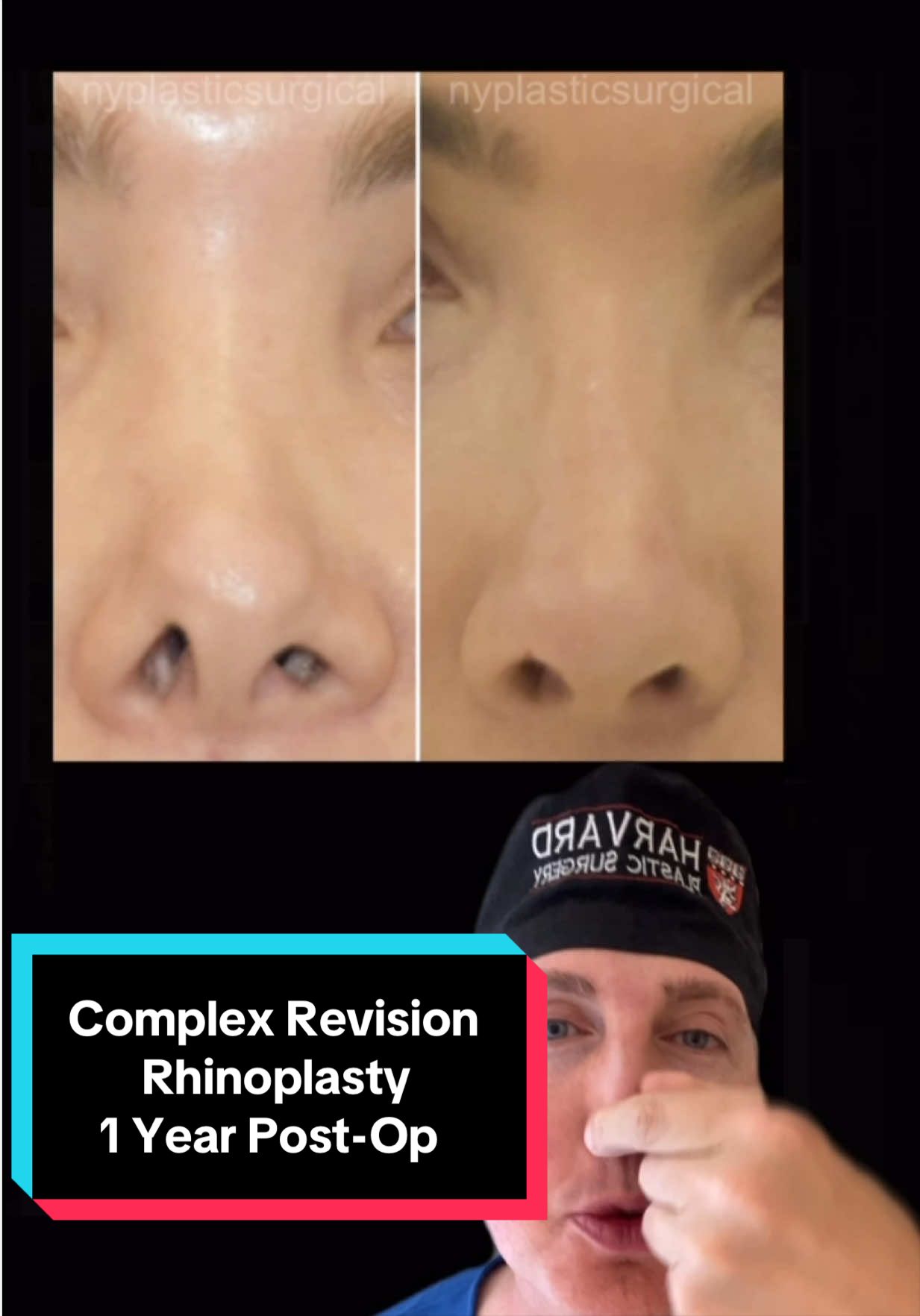 @Dr. Richard Reish, M.D., FACS