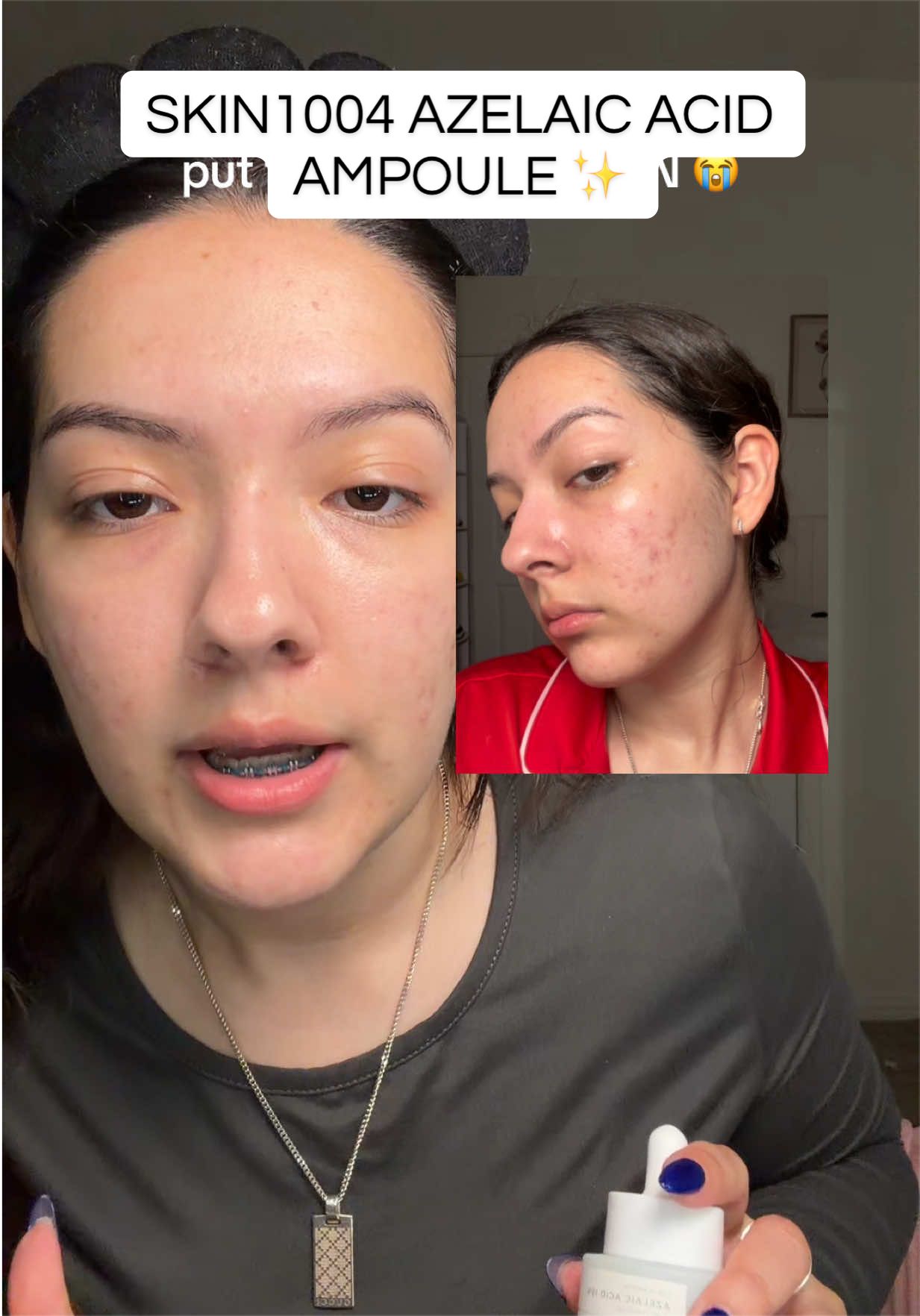 @Jeimy